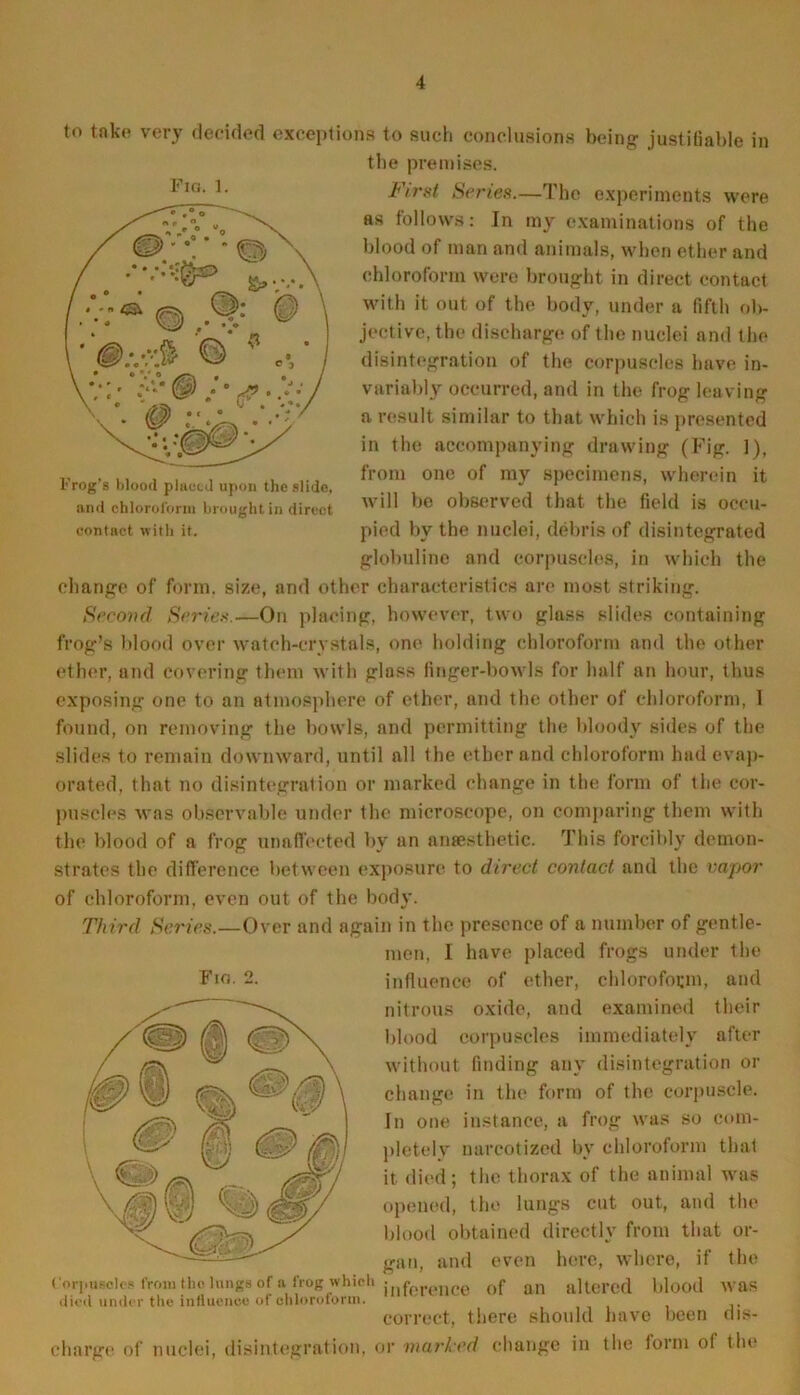 to take very decided exceptions to such conclusions being justifiable in the premises. First Series.—The experiments were as follows: In my examinations of the blood of man and animals, when ether and chloroform were brought in direct contact with it out of the body, under a fifth ob- jective, the discharge of the nuclei and the disintegration of the corpuscles have in- variably occurred, and in the frog lea ving a result similar to that which is presented in the accompanying drawing (Fig. 1), from one of my specimens, wherein it will be observed that the field is occu- pied by the nuclei, debris of disintegrated globuline and corpuscles, in which the change of form, size, and other characteristics are most striking. Second Series.—On placing, however, two glass slides containing frog’s blood over watch-crystals, one holding chloroform nnd the other ether, and covering them with glass finger-bowls for half an hour, thus exposing one to an atmosphere of ether, and the other of chloroform, 1 found, on removing the bowls, and permitting the bloody sides of the slides to remain downward, until all the ether and chloroform had evap- orated, that no disintegration or marked change in the form of the cor- puscles was observable under the microscope, on comparing them with the blood of a frog unaffected by an anaesthetic. This forcibly demon- strates the difference between exposure to direct contact and the vapor of chloroform, even out of the body. Third Series.—Over and again in the presence of a number of gentle- men, I have placed frogs under the influence of ether, chloroform, and nitrous oxide, and examined their blood corpuscles immediately after without finding any disintegration or change in the form of the corpuscle. In one instance, a frog was so com- pletely narcotized by chloroform that it died; the thorax of the animal was opened, the lungs cut out, and the blood obtained directly from that or- gan, and even here, where, if the Corpuscles from the lungs of a_frog which jnference 0f an altered blood Was diccl under the influence of chloroform. correct, there should have been nis- charge of nuclei, disintegration, or marked change in the form ol tin1 Fio. 2. Fia. 1. Frog's blood placed upon the slide, and chloroform brought in direct contact with it.