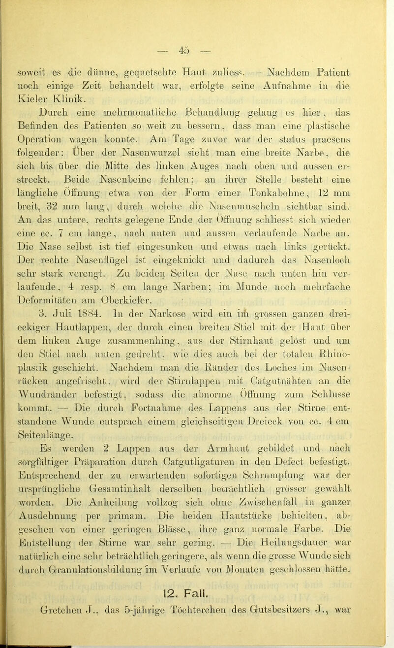 soweit es die dünne, gequetschte Haut zuliess. — Nachdem Patient noch einige Zeit behandelt war, erfolgte seine Aufnahme in die Kieler Klinik. Durch eine mehrmonatliche Behandlung gelaug es hier, das Befinden des Patienten so weit zu bessern, dass man eine plastische Operation wagen konnte. Am Tage zuvor war der status praesens folgender: Über der Nasenwurzel sieht man eine breite Narbe, die sich bis über die Mitte des linken Auges nach oben und aussen er- streckt. Beide Nasenbeine fehlen; an ihrer Stelle besteht eine längliche Öffnung etwa von der Form einer Tonkaboline, 12 mm breit, 32 mm lang, durch welche die Nasenmuschelir sichtbar sind. An das untere, rechts gelegene Ende der Öffnung schliesst sich wieder eine cc. 7 cm lange, nach unten und aussen verlaufende Narbe an. Die Nase seihst ist tief eingesunken und etwas nach links gerückt. Der rechte Nasenflügel ist eingeknickt und dadurch das Nasenloch sehr stark verengt. Zu beiden Seiten der Nase nach unten hin ver- laufende , 4 resp. 8 cm lange Narben; im Munde noch mehrfache Deformitäten am Oberkiefer. o. J uli 1884. ln der Narkose wird ein iifi grossen ganzen drei- eckiger Hautlappen, der durch einen breiten Stiel mit der Haut über dem linken Auge zusammenhing, aus der Stirnhaut gelüst und um den Stiel nach unten gedreht, wie dies auch bei der totalen Rhino- plastik geschieht. Nachdem man die Ränder des Loches im Nasen- rücken angefrischt, wird der Stirnlappen mit Catgutnähten an die Wundränder befestigt, sodass die abnorme Öffnung zum Schlüsse kommt. Die durch Fortnahme des Lappens aus der Stirne ent- standene Wunde entsprach einem gleichseitigen Dreieck von cc. 4 cm Seitenlange. Es werden 2 Lappen aus der Armhaut gebildet und nach sorgfältiger Präparation durch Catgutligaturen in den Defect befestigt. Entsprechend der zu erwartenden sofortigen Schrumpfung war der ursprüngliche Gesamtinhalt derselben beträchtlich grösser gewählt worden. Die Anheilung vollzog sich ohne Zwischenfall in ganzer Ausdehnung per priinam. Die beiden Hautstücke behielten, ab- gesehen von einer geringen Blässe, ihre ganz normale Farbe. Die Entstellung der Stirne war sehr gering. — Die Heilungsdaucr war natürlich eiue sehr beträchtlich geringere, als wenn die grosse Wunde sich durch Granulationsbildung im Verlaufe von Monaten geschlossen hätte. 12. Fall. Gretclien ,T., das 5-jährige Töchterchen des Gutsbesitzers J., war