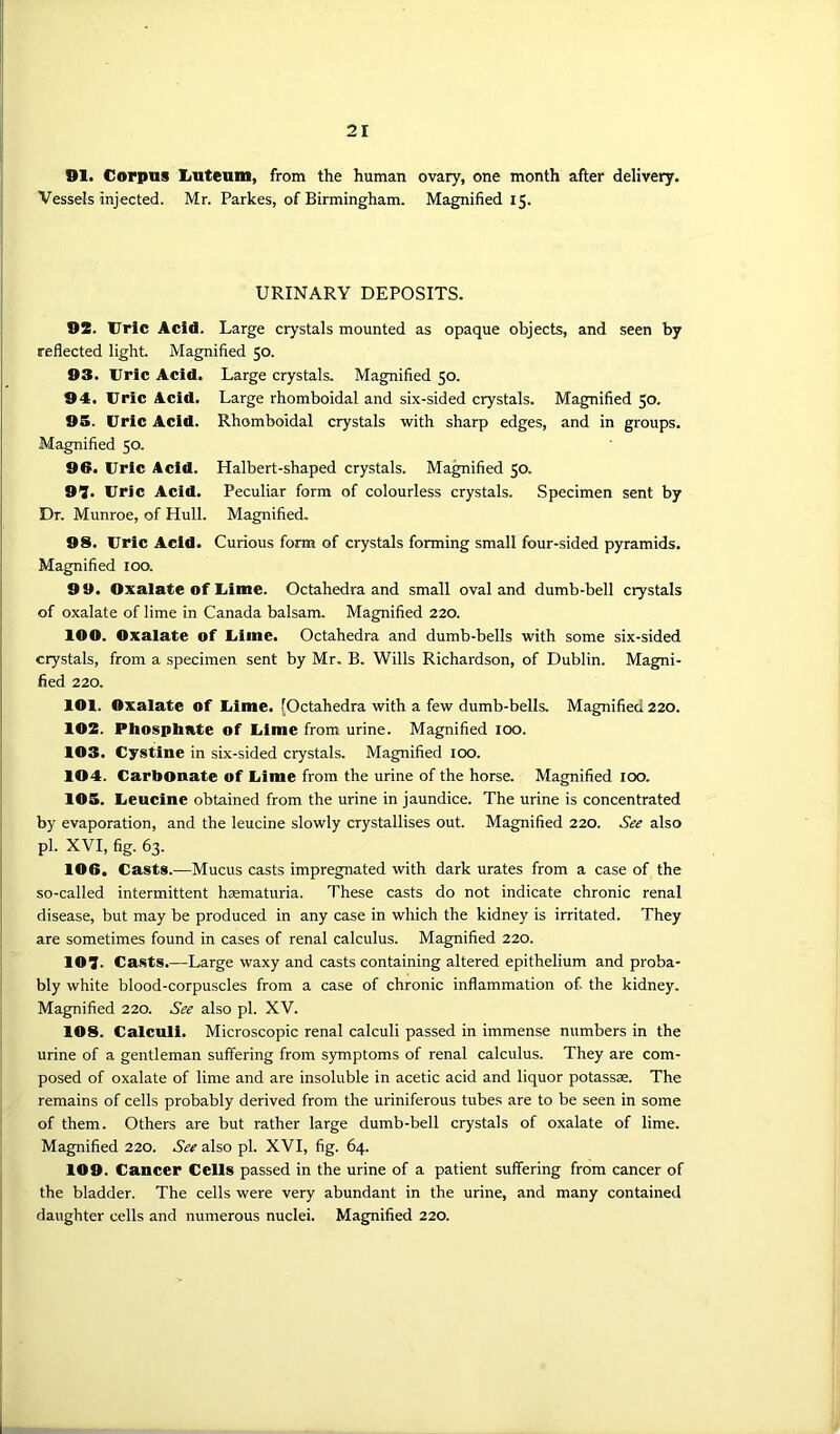 91. Corpus Luteum, from the human Vessels injected. Mr. Parkes, of Birmingham. ovary, one month after delivery. Magnified 15. URINARY DEPOSITS. 92. Uric Acid. Large crystals mounted as opaque objects, and seen by reflected light. Magnified 50. 93. Uric Acid. Large crystals. Magnified 50. 94. Uric Acid. Large rhomboidal and six-sided crystals. Magnified 50. 95. Uric Acid. Rhomboidal crystals with sharp edges, and in groups. Magnified 50. 96. Uric Acid. Halbert-shaped crystals. Magnified 50. 97. Uric Acid. Peculiar form of colourless crystals. Specimen sent by Dr. Munroe, of Hull. Magnified. 98. Uric Acid. Curious form of crystals forming small four-sided pyramids. Magnified 100. 99. Oxalate of Uime. Octahedra and small oval and dumb-bell crystals of oxalate of lime in Canada balsam. Magnified 220. 100. Oxalate of Uime. Octahedra and dumb-bells with some six-sided crystals, from a specimen sent by Mr. B. Wills Richardson, of Dublin. Magni- fied 220. 101. Oxalate of Uime. [Octahedra with a few dumb-bells. Magnified 220. 102. Phosphate of Uime from urine. Magnified 100. 103. Cystine in six-sided crystals. Magnified 100. 104. Carbonate of Uime from the urine of the horse. Magnified 100. 105. Ueucine obtained from the urine in jaundice. The urine is concentrated by evaporation, and the leucine slowly crystallises out. Magnified 220. See also pi. XVI, fig. 63. 106. Casts.—Mucus casts impregnated with dark urates from a case of the so-called intermittent heematuria. These casts do not indicate chronic renal disease, but may be produced in any case in which the kidney is irritated. They are sometimes found in cases of renal calculus. Magnified 220. 107. Casts.—Large waxy and casts containing altered epithelium and proba- bly white blood-corpuscles from a case of chronic inflammation of. the kidney. Magnified 220. See also pi. XV. 108. Calculi. Microscopic renal calculi passed in immense numbers in the urine of a gentleman suffering from symptoms of renal calculus. They are com- posed of oxalate of lime and are insoluble in acetic acid and liquor potass®. The remains of cells probably derived from the uriniferous tubes are to be seen in some of them. Others are but rather large dumb-bell crystals of oxalate of lime. Magnified 220. See also pi. XVI, fig. 64. 109. Cancer Cells passed in the urine of a patient suffering from cancer of the bladder. The cells were very abundant in the urine, and many contained daughter cells and numerous nuclei. Magnified 220.