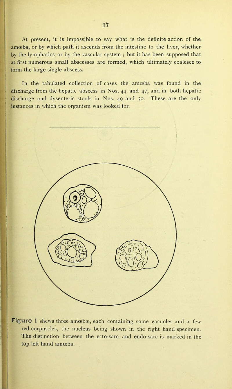 At present, it is impossible to say what is the definite action of the amoeba, or by which path it ascends from the intestine to the liver, whether by the lymphatics or by the vascular system ; but it has been supposed that at first numerous small abscesses are formed, which ultimately coalesce to form the large single abscess. In the tabulated collection of cases the amoeba was found in the discharge from the hepatic abscess in Nos. 44 and 47, and in both hepatic discharge and dysenteric stools in Nos. 49 and 50. These are the only instances in which the organism was looked for. Figure 1 shews three amcebse, each containing some vacuoles and a few red corpuscles, the nucleus being shown in the right hand specimen. The distinction between the ecto-sarc and endo-sarc is marked in the top left hand amoeba.