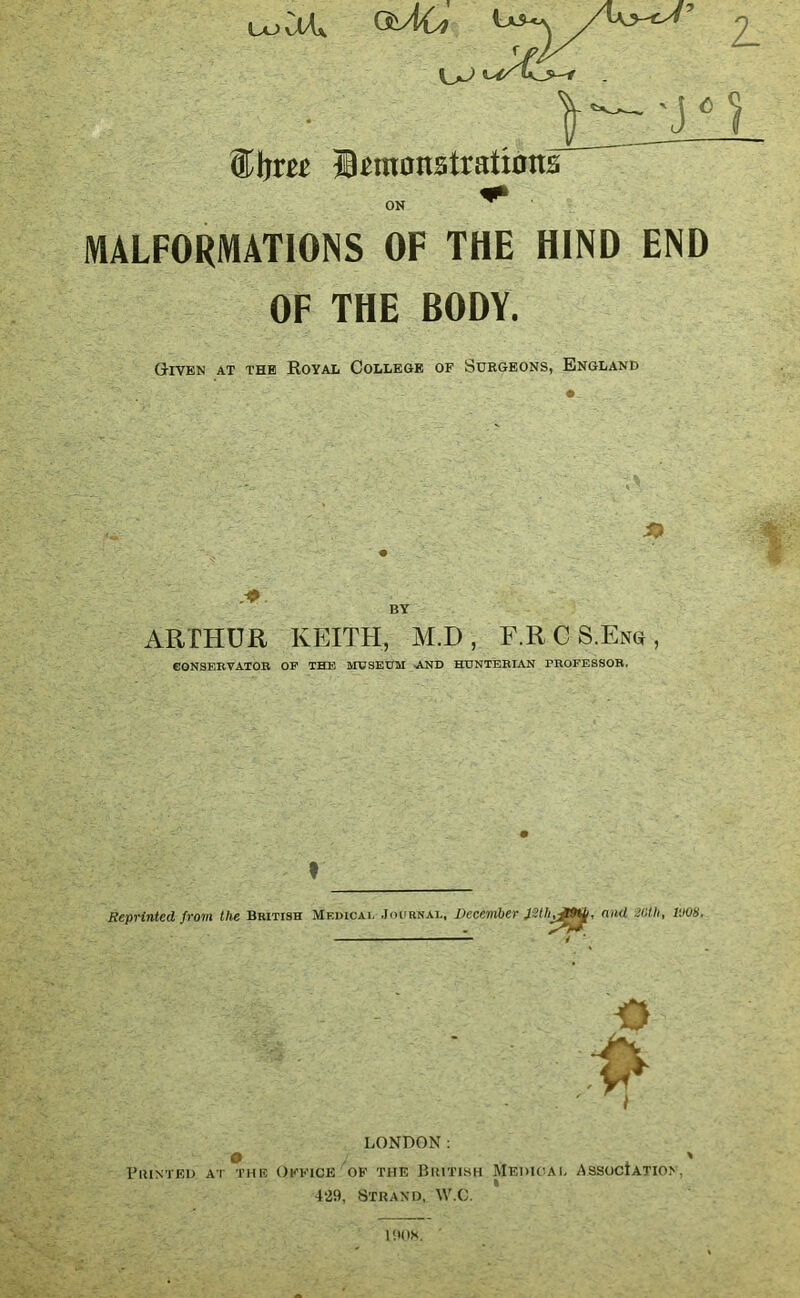 <5 uoCUx ®br^^ jB^m0nstrati0ns ON MALFORMATIONS OF THE HIND END OF THE BODY. Given at the Royal College of Surgeons, England BY ARTHUR KEITH, M.D , F.R C S.Eng , eONSEBVATOB OF THE MUSEUM .AND HONTEBIAN PBOFESSOB. t Reprinted from the British Medical .Ioubnal, December nnd Xtli, vm. I ' LONDON; Viunted at the Office of the British Medical Association, 429, Strand, M'.C. I'.inx.