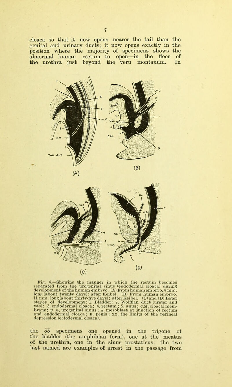 cloaca so that it now opens nearer the tail than the genital and urinary ducts; it now opens exactly in the position where the majority of specimens shows the abnormal human rectum to open—in the floor of the urethra just beyond the veru montanum. In Fig. 4.—Showing the manner in which llie recttun becomes separated from the urogenital sinus (endodermal cloaca) during development of thehuman embryo. (A) From human embryo, 4 mm. long (about twenty days); alter Keibel. (B) Fx-om human embryo, 11 mm. long (about thirty-five days); after Keibel. (C) and (D) Later stages of development: 1, Bladder; 2, WoliBan duct (ureter and vas); 3, endodermal cloaca; 4, rectum ; 5, anus ; c.m, cloacal mem- brane: u. o, urogenital sinus; a, mesoblast at junction of rectum and endodermal eloaca: B, penis ; xx, the limits of the perineal depression (ectodermal cloaca). the 33 specimens one opened in the trigone of the bladder (the amphibian form), one at the meatus of the urethra, one in the sinus prostaticus; the two last named are examples of arrest in the passage from