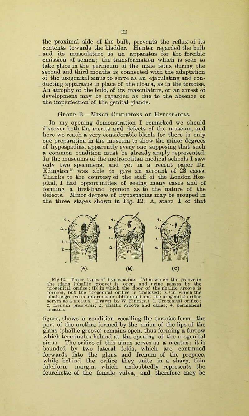 the proximal side of the bulb, prevents the reflux of its contents towards the bladder. Hunter regarded the bulb and its musculature as an apparatus for the forcible emission of semen; the transformation which is seen to take place in the perineum of the male fetus during the second and third months is connected with the adaptation of the urogenital sinus to serve as an ejaculating and con- ducting apparatus in place of the cloaca, as in the tortoise. An atrophy of the bulb, of its musculature, or an arrest of development may be regarded as due to the absence or the imperfection of the genital glands. Group B.—Minor Conditions of Hypospadias. In my opening demonstration I remarked we should discover both the merits and defects of the museum, and here we reach a very considerable blank, for there is only one preparation in the museum to show the minor degrees of hypospadias, apparently every one supposing that such a common condition must he already amply represented. In the museums of the metropolitan medical schools I saw only two specimens, and yet in a recent paper Dr. Edington'® was able to give an account of 28 cases. Thanks to the courtesy of the staff of the London Hos- pital, I had opportunities of seeing many cases and of forming a first-hand opinion as to the nature of the defects. Minor degrees of hypospadias may be grouped in the three stages shown in Fig. 12; A, stags 1 of that Fig 12.—Three types of hypospadias—(A) in which the groove in the glans (phallic groove) is open, and urine passes by the urogenital orifice; (B) in which the floor of the phallic groove is formed, but the urogenital orifice is unclosed; (C) in which the phallic groove is unformed or obliterated and the urogenital orifice serves as a meatus. (Drawn by W. Finerty.) 1, Urogenital orifice ; 2, frenum praeputii; 3, phallic groove and canal; 4, permanent meatus. figure, shows a condition recalling the tortoise form—the part of the urethra formed by the union of the lips of the glans (phallic groove) remains open, thus forming a furrow which terminates behind at the opening of the urogenital sinus. The orifice of this sinus serves as a meatus ; it is bounded by two lateral folds, which are continued forwards into the glans and frenum of the prepuce, while behind the orifice they unite in a sharp, thin falciform margin, which undoubtedly represents the fourchette of the female vulva, and therefore may be