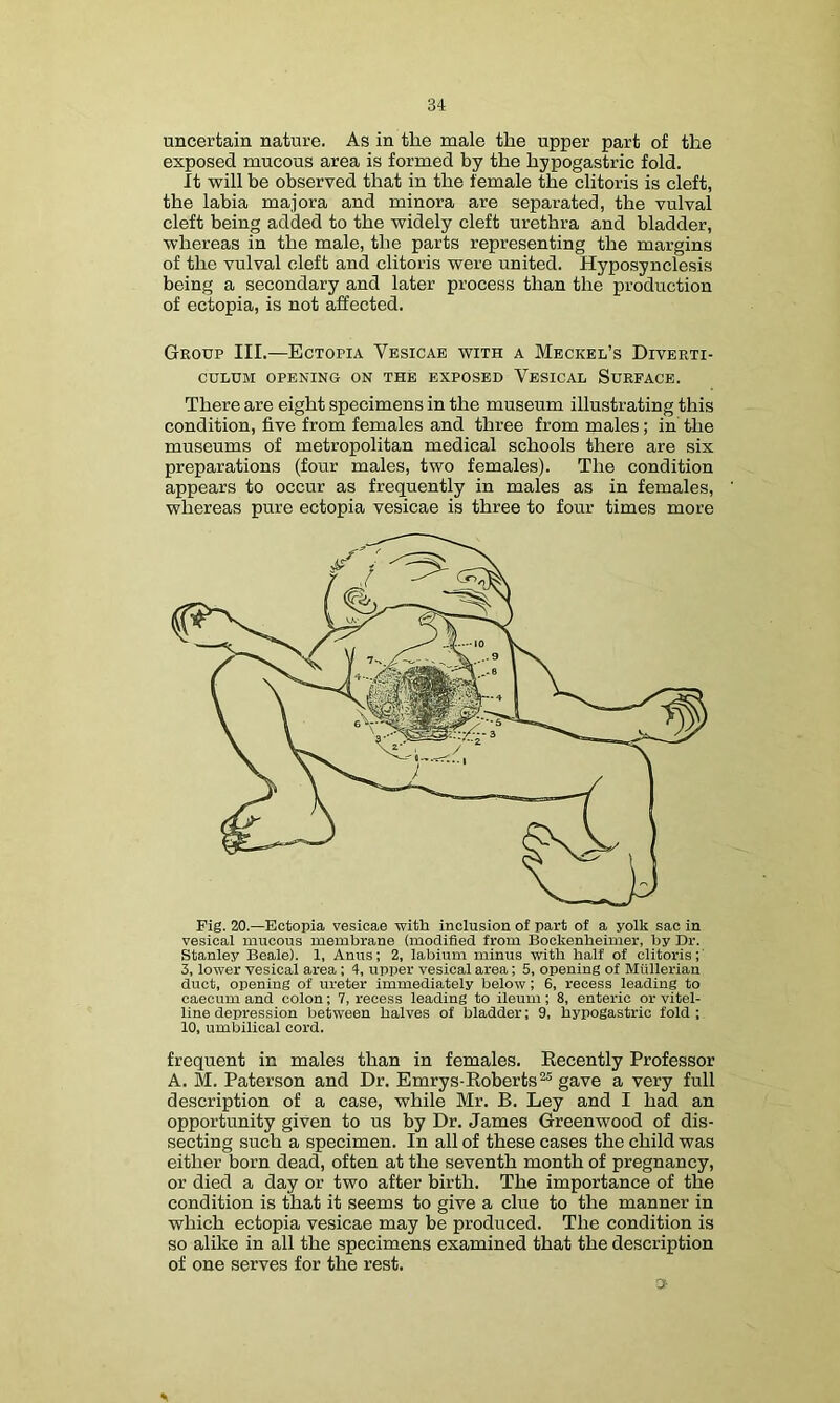 uncertain nature. As in the male the upper part of the exposed mucous area is formed by the hypogastric fold. It will be observed that in the female the clitoris is cleft, the labia majora and minora are separated, the vulval cleft being added to the widely cleft urethra and bladder, whereas in the male, the parts representing the margins of the vulval cleft and clitoris were united. Hyposynclesis being a secondary and later process than the production of ectopia, is not affected. Gkoup III.—Ectopia Vesicab with a Meckel’s Diverti- culum OPENING ON THE EXPOSED VeSICAL SURFACE. There are eight specimens in the museum illustrating this condition, five from females and three from males; in the museums of metropolitan medical schools there are six preparations (four males, two females). The condition appears to occur as frequently in males as in females, whereas pure ectopia vesicae is three to four times more Fig. 20.—Ectopia vesicae with inclusion of part of a yolk sac in vesical mucous membrane (modified from Bockenheimer, by Dr. Stanley Beale). 1, Anus; 2, labium minus with half of clitoris;' 3, lower vesical area ; 4, upper vesical area; 5, opening of Mullerian duct, opening of ureter immediately below; 6, recess leading to caecum and colon; 7, recess leading to ileum; 8, enteric or vitel- line depression between halves of bladder; 9, hypogastric fold ; 10, umbilical cord. frequent in males than in females. Eecently Professor A. M. Paterson and Dr. Emrys-Eoberts^ gave a very full description of a case, while Mr. B. Ley and I had an opportunity given to us by Dr. James Greenwood of dis- secting such a specimen. In all of these cases the child was either born dead, often at the seventh month of pregnancy, or died a day or two after birth. The importance of the condition is that it seems to give a clue to the manner in which ectopia vesicae may be produced. The condition is so alike in all the specimens examined that the description of one serves for the rest.