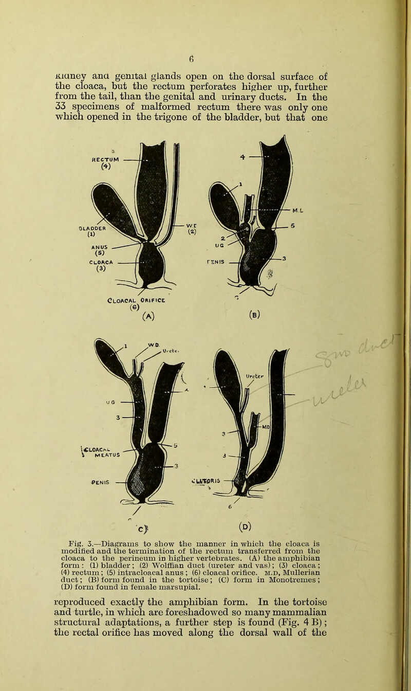 fi iiiuney ana genital glands open on the dorsal surface of the cloaca, but the rectum perforates higher up, further from the tail, than the genital and urinary ducts. In the 33 specimens of malformed rectum there was only one which opened in the trigone of the bladder, but that one Cloacal Orifice / c> (d) Fig. 3.—Diagrams to show the manner in which the cloaca is modified and the termination of the rectum transferred from the cloaca to the perineum in higher vertebrates. (A) the amphibian form : (1) bladder; (2) Wolffian duct (ureter and vas); (3) cloaca; (4) rectum; (5) intracloacal anus ; (6) cloacal orifice, m.d, Mullerian duct; (B) form found in the tortoise ; (C) form in Monotremes ; (D) form found in female marsupial. reproduced exactly the amphibian form. In the tortoise and turtle, in which are foreshadowed so many mammalian structural adaptations, a further step is found (Fig. 4 B); the rectal orifice has moved along the dorsal wall of the