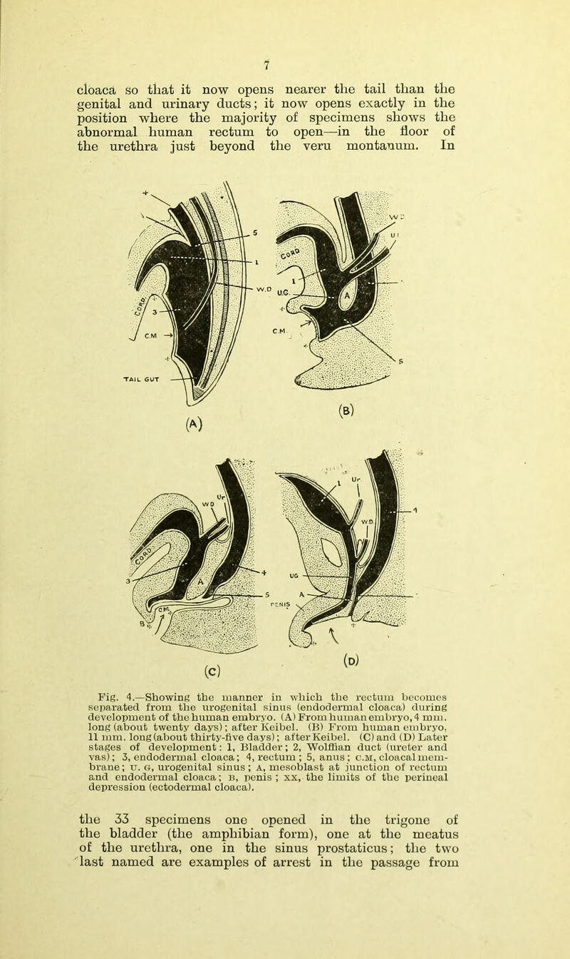 cloaca so that it now opens nearer the tail than the genital and urinary ducts; it now opens exactly in the position where the majority of specimens shows the abnormal human rectum to open—in the floor of the urethra just beyond the veru montanum. In Pig. 4.—Showing the manner in which tlie rectum becomes separated from the urogenital sinus (endodermal cloaca) during development of thehuman embryo. (A) From human embryo, 4 mm. long (about twenty days); after Keibel. (K) From human embryo. 11 mm. long (about thirty-five days); after Keibel. (C) and (D) Later stages of development: 1, Bladder; 2, Wolffian duct (ureter and vas): 3, endodermal cloaca; 4, rectum ; 5, anus ; c.ai, cloacal mem- brane ; tr. », urogenital sinus; a, mesoblast at junction of rectum and endodermal cloaca; n, iienis ; xx, the limits of the perineal depression (ectodermal cloaca). the 33 specimens one opened in the trigone of the bladder (the amphibian form), one at the meatus of the urethra, one in the sinus prostaticus; the two last named are examples of arrest in the passage from