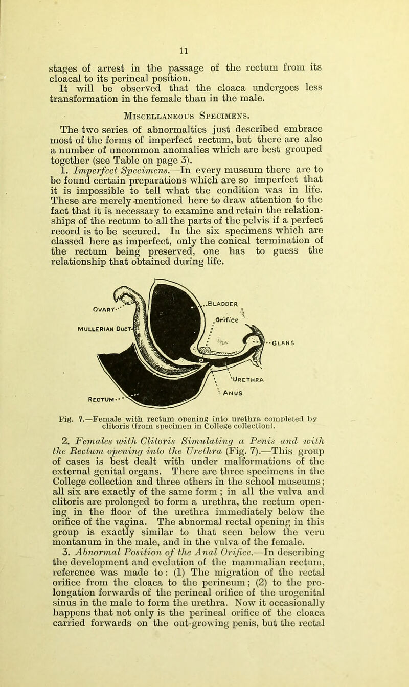 stages of arrest in the passage of the rectum from its cloacal to its perineal position. It will be observed that the cloaca undergoes less transformation in the female than in the male. Miscellaneous Specimens. The two series of abnormalties just described embrace most of the forms of imperfect rectum, but there are also a number of uncommon anomalies which are best grouped together (see Table on page 3). 1. Imperfect Sjjecimens.—In every museum there are to be found certain preparations which are so imperfect that it is impossible to tell what the condition was in life. These are merely -mentioned here to draw attention to the fact that it is necessary to examine and retain the relation- ships of the rectum to all the parts of the pelvis if a perfect record is to be secured. In the six specimens which are classed here as imperfect, only the conical termination of the rectum being preserved, one has to guess the relationship that obtained during life. .Orifice ••Clans '• Anus Fig. 7.—Female with rectum opening into urethra completed by clitoris (from specimen in College collection). 2. Females ivith Clitoris Simulating a Penis and with the Eechini opening into the Urethra (Fig. 7).—This group of cases is best dealt with under malformations of the external genital organs. There are three specimens in the College collection and three others in the school museums; all six are exactly of the same form ; in all the vulva and clitoris are prolonged to form a urethra, the rectum open- ing in the floor of the urethra immediately below the orifice of the vagina. The abnormal rectal opening in this group is exactly similar to that seen below the veru montanum in the male, and in the vulva of the female. 3. Abnormal Position of the Anal Orifice.—In describing the development and evolution of the mammalian rectum, reference was made to: (1) The migration of the rectal orifice from the cloaca to the perineum; (2) to the pro- longation forwards of the perineal orifice of the urogenital sinus in the male to form the urethra. Now it occasionally happens that not only is the perineal orifice of the cloaca carried forwards on the out-growing penis, but the rectal