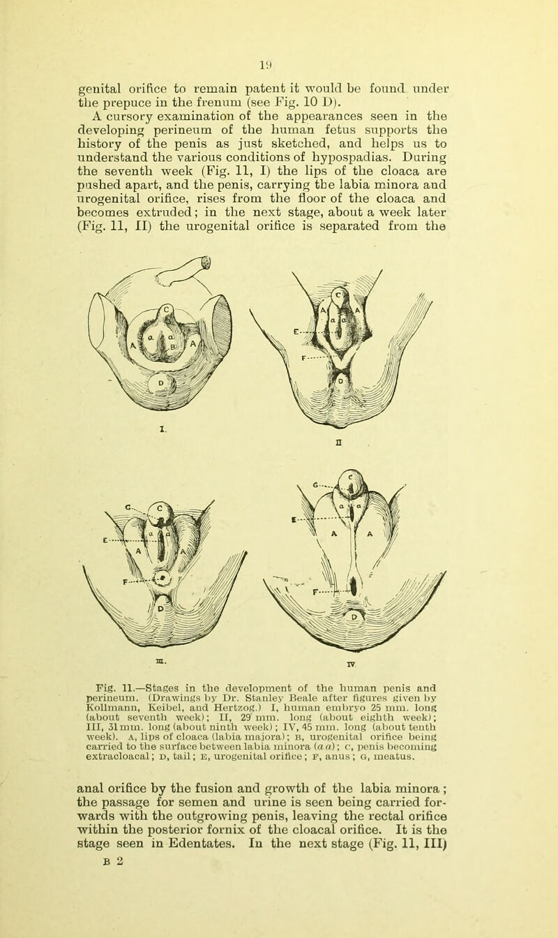 lit genital orifice to remain patent it would be found under the prepuce in the frenum (see Fig. 10 D). A cursory examination of the appearances seen in the developing perineum of the human fetus supports the history of the penis as just sketched, and helps us to understand the various conditions of hypospadias. During the seventh week (Fig. 11, I) the lips of the cloaca are pushed apart, and the penis, carrying the labia minora and urogenital orifice, rises from the floor of the cloaca and becomes extruded; in the next stage, about a week later (Fig. 11, II) the urogenital orifice is separated from the 1, Fig. 11.—Stages in the development of the human penis and perineum. (Drawings Ijy Dr. Stanley Beale after figures given l>y Kollmann, Keibel, and Hertzog.) 1, human embryo 25 mm. long (about seventh week); II, 29 mm. long (al)out eighth week); III, 31mm. long (al)out ninth week); IV, 45 mm. long (about tenth week). A, lips of cloaca (labia majora); i!, urogenital orifice being carried to the surface between labia minora (an); c, penis becoming extracloacal; n, tail; e, urogenital orifice; f, anus; g, meatus. anal orifice by the fusion and growth of the labia minora ; the passage for semen and urine is seen being carried for- wards with the outgrowing penis, leaving the rectal orifice within the posterior fornix of the cloacal orifice. It is the stage seen in Edentates. In the next stage (Fig. 11, III) B 2