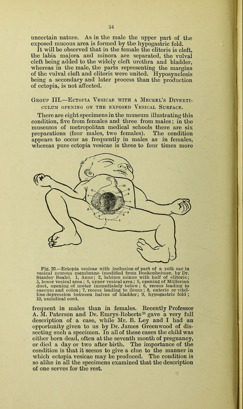 uncertain nature. As in the male the upper part of the exposed mucous area is formed by the hypogastric fold. It will be observed that in the female the clitoris is cleft, the labia majora and minora are separated, the vulval cleft being added to the widely cleft urethra and bladder, whereas in the male, the parts representing the margins of the vulval cleft and clitoris were united. Hyposynclesis being a secondary and later process than the production of ectopia, is not affected. Group III.—Ectopia Vesicab with a Meckel’s Diverti- culum OPENING ON THE EXPOSED VeSICAL SURFACE. There are eight specimens in the museum illustrating this condition, five from females and three from males; in the museums of metropolitan medical schools there are six preparations (four males, two females). The condition appears to occur as frequently in males as in females, whereas pure ectopia vesicae is three to four times more Pig. 20.—Ectopia vesicae with inclusion of part of a yolk sac in vesical mucous membrane (modified from Bockenheimer, by Dr. Stanley Beale). 1, Anus; 2, labium minus with half of clitoris; 3, lower vesical area; 4, upper vesical area; 5, opening of Mullerian duct, opening of ureter immediately below; 6, recess leading to caecum and colon; 7, recess leading to ileum; 8, enteric or vitel- line depression between halves of bladder; 9, hypogastric fold; 10, umbilical cord. frequent in males than in females. Recently Professor A. M. Paterson and Dr. Emrys-Roberts^® gave a very full description of a case, while Mr. B. Ley and I had an opportunity given to us by Dr. James Greenwood of dis- secting such a specimen. In all of these cases the child was either born dead, often at the seventh month of pregnancy, or died a day or two after birth. The importance of the condition is that it seems to give a clue to the manner in which ectopia vesicae may be produced. The condition is so alike in all the specimens examined that the description of one serves for the rest.