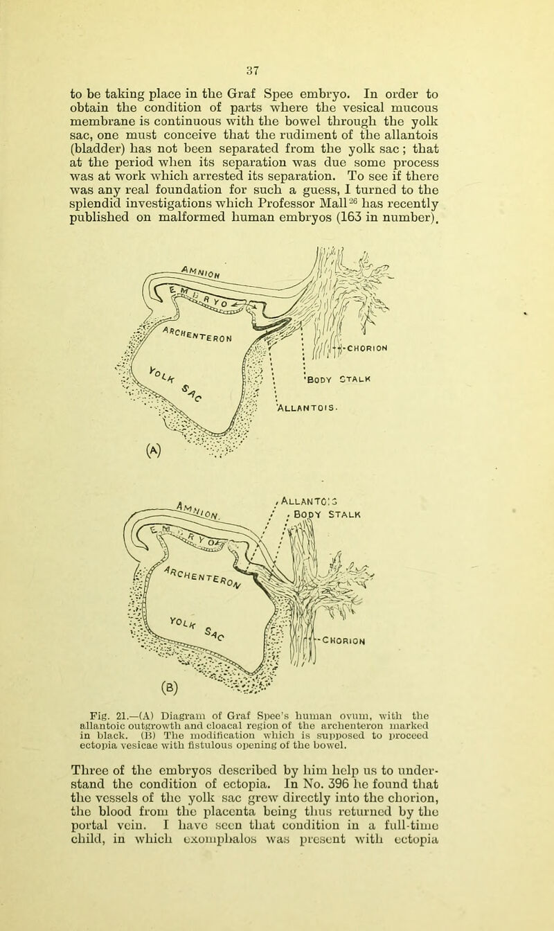 to be taking place in the Graf Spec embryo. In order to obtain the condition of parts where the vesical mucous membrane is continuous with the bowel through the yolk sac, one must conceive that the rudiment of the allantois (bladder) has not been separated from the yolk sac; that at the period when its separation was due some process was at work which arrested its separation. To see if there was any real foundation for such a guess, 1 turned to the splendid investigations which Professor Mall-® has recently published on malformed human embryos (163 in number). Fig. 21.—(A) Diagram of Graf Spee’s human ovum, -with the allantoic outgrowth and cloacal region of the archenteron marked in black. (H) The modification which is supposed to proceed ectopia vesicae w’ith fistulous opening of the bowel. Three of the embryos described by him help us to under- stand the condition of ectopia. In No. 396 he found that the vessels of the yolk sac grew directly into the chorion, the blood from the placenta being thus returned by the portal vein. I have seen that condition in a full time child, in which exomphalos was present with ectopia