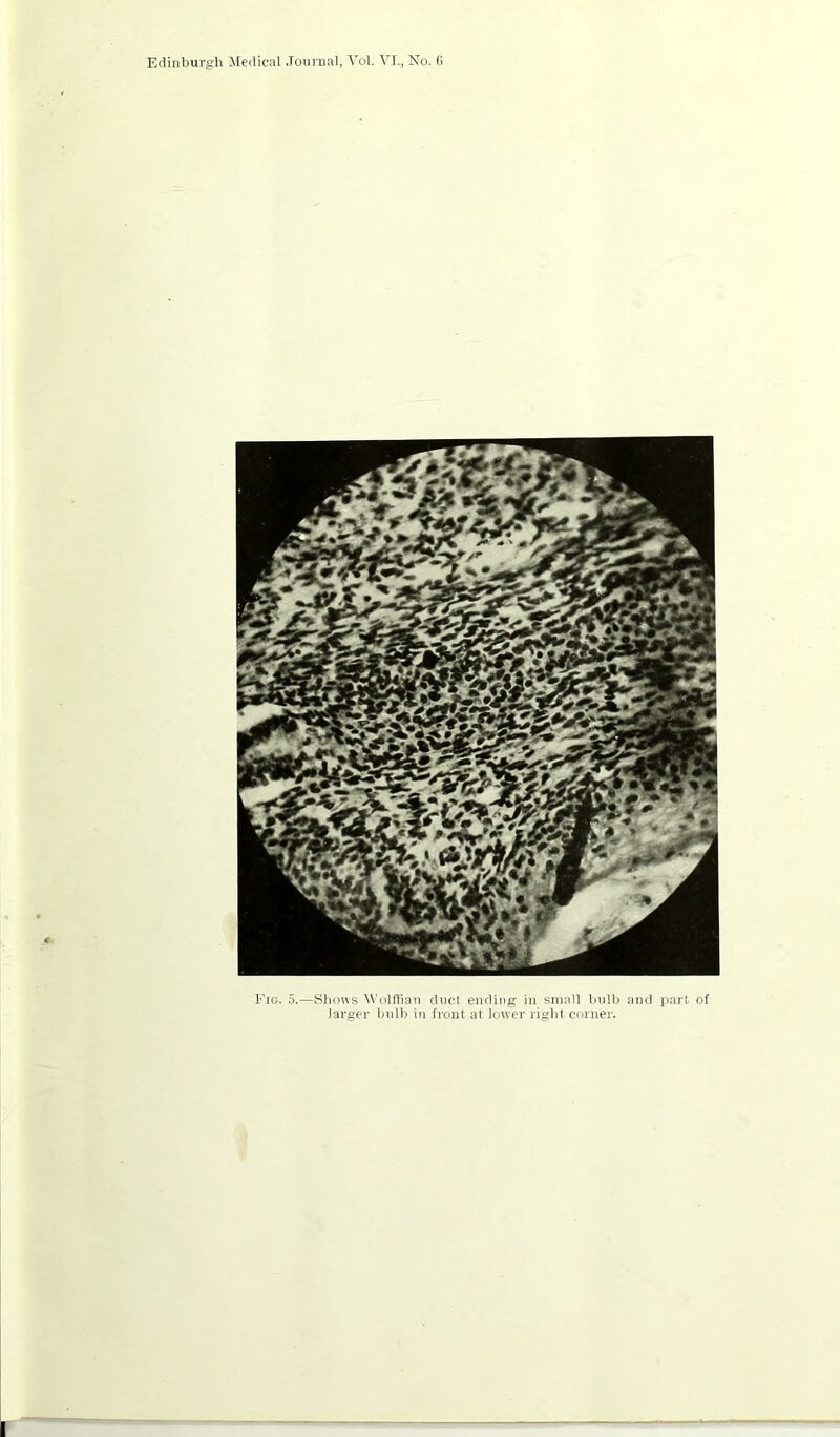 Eio. 5.—Shows Wolffian duct ending in small luilb and part of larger bulb in front at lower right coiner.