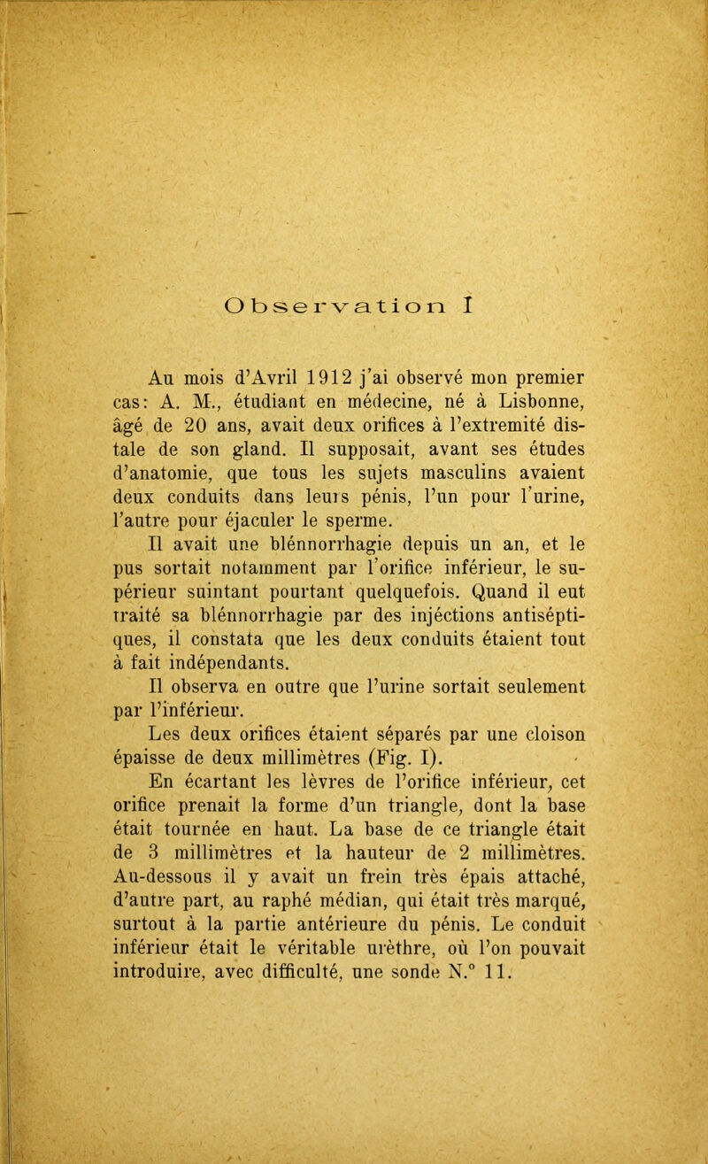 Au mois d’Avril 1912 j’ai observé mon premier cas: A. M-., étudiant en médecine, né à Lisbonne, âgé de 20 ans, avait deux orifices à l’extremité dis- tale de son gland. Il supposait, avant ses études d’anatomie, que tous les sujets masculins avaient deux conduits dans leurs pénis, l’un pour l’urine, l’autre pour éjaculer le sperme. Il avait une blénnorrhagie depuis un an, et le pus sortait notamment par l’orifice inférieur, le su- périeur suintant pourtant quelquefois. Quand il eut traité sa blénnorrhagie par des injéctions antisépti- ques, il constata que les deux conduits étaient tout à fait indépendants. Il observa en outre que l’urine sortait seulement par l’inférieur. Les deux orifices étaient séparés par une cloison épaisse de deux millimètres (Fig. I). En écartant les lèvres de l’orifice inférieur, cet orifice prenait la forme d’un triangle, dont la base était tournée en haut. La base de ce triangle était de 3 millimètres et la hauteur de 2 millimètres. Au-dessous il y avait un frein très épais attaché, d’autre part, au raphé médian, qui était très marqué, surtout à la partie antérieure du pénis. Le conduit inférieur était le véritable urèthre, où l’on pouvait introduire, avec difficulté, une sonde N.° 11.