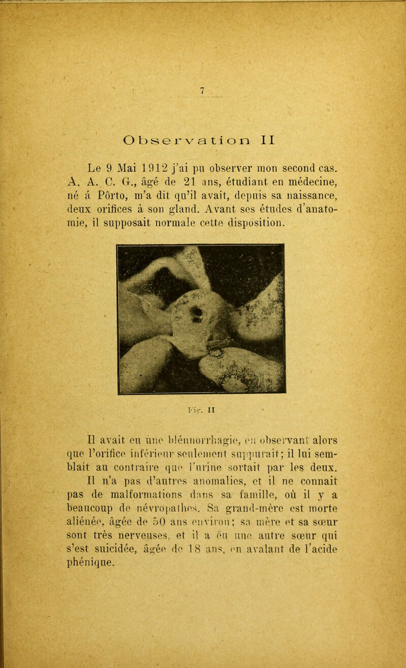 7 Observation II Le 9 Mai 1912 j’ai pu observer mon second cas. A. A. C. G., âgé de 21 ans, étudiant en médecine, né â Porto, m’a dit qu’il avait, depuis sa naissance, deux orifices à son gland. Avant ses études d’anato- mie, il supposait normale cette disposition. I-iî-. Il Il avait ou une blénnorrhagie, on observant alors que l’orifice inférieur seulement suppurait ; il lui sem- blait au contraire que burine sortait par les deux. Il n’a pas d’autres anomalies, et il ne connait pas de malformations dans sa famille, où il y a beaucoup de névropathes. Sa grand-mère est morte aliénée, âgée de 50 ans environ; sa mère et sa sœur sont très nerveuses, et il a eu une autre sœur qui s’est suicidée, âgée de 18 ans, en avalant de l’acide phénique.