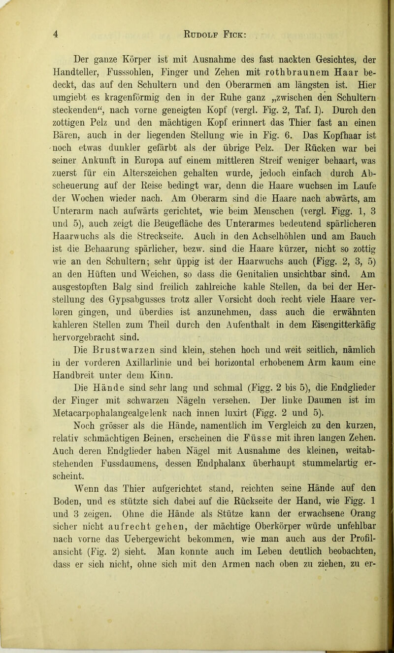 Der gauze Körper ist mit Ausnahme des fast nackten Gesichtes, der Handteller, Fusssohlen, Finger und Zehen mit rothbraunem Haar be- deckt, das auf den Schultern und den Oberarmen am längsten ist. Hier umgiebt es kragenförmig den in der Ruhe ganz „zwischen den Schultern steckenden“, nach vorne geneigten Kopf (vergl. Fig. 2, Taf. I). Durch den zottigen Pelz und den mächtigen Kopf erinnert das Thier fast an einen Bären, auch in der liegenden Stellung wie in Fig. 6. Das Kopfhaar ist noch etwas dunkler gefärbt als der übrige Pelz. Der Rücken war bei seiner Ankunft in Europa auf einem mittleren Streif weniger behaart, was zuerst für ein Alterszeichen gehalten wurde, jedoch einfach durch Ab- scheuerung auf der Reise bedingt war, denn die Haare wuchsen im Laufe der Wochen wieder nach. Am Oberarm sind die Haare nach abwärts, am Unterarm nach aufwärts gerichtet, wie beim Menschen (vergl. Figg. 1, 3 und 5), auch zeigt die Beügefläche des Unterarmes bedeutend spärlicheren Haarwuchs als die Streckseite. Auch in den Achselhöhlen und am Bauch ist die Behaarung spärlicher, bezw. sind die Haare kürzer, nicht so zottig wie an den Schultern; sehr üppig ist der Haarwuchs auch (Figg. 2, 3, 5) an den Hüften und Weichen, so dass die Genitalien unsichtbar sind. Am ausgestopften Balg sind freilich zahlreiche kahle Stellen, da bei der Her- stellung des Gypsabgusses trotz aller Vorsicht doch recht viele Haare ver- loren gingen, und überdies ist anzunehmen, dass auch die erwähnten kahleren Stellen zum Theil durch den Aufenthalt in dem Eisengitterkäfig hervorgebracht sind. Die Brustwarzen sind klein, stehen hoch und weit seitlich, nämlich in der vorderen Axillarlinie und bei horizontal erhobenem Arm kaum eine Handbreit unter dem Kinn. Die Hände sind sehr lang und schmal (Figg. 2 bis 5), die Endglieder der Finger mit schwarzen Nägeln versehen. Der linke Daumen ist im Metacarpophalangealgelenk nach innen luxirt (Figg. 2 und 5). Noch grösser als die Hände, namentlich im Vergleich zu den kurzen, relativ schmächtigen Beinen, erscheinen die Füsse mit ihren langen Zehen. Auch deren Endglieder haben Nägel mit Ausnahme des kleinen, weitab- stehenden Fussdaumens, dessen Endphalanx überhaupt stummelartig er- scheint. Wenn das Thier aufgerichtet stand, reichten seine Hände auf den Boden, und es stützte sich dabei auf die Rückseite der Hand, wie Figg. 1 und 3 zeigen. Ohne die Hände als Stütze kann der erwachsene Orang sicher nicht aufrecht gehen, der mächtige Oberkörper würde unfehlbar nach vorne das Uebergewicht bekommen, wie man auch aus der Profil- ansicht (Fig. 2) sieht. Man konnte auch im Leben deutlich beobachten, dass er sich nicht, ohne sich mit den Armen nach oben zu ziehen, zu er-