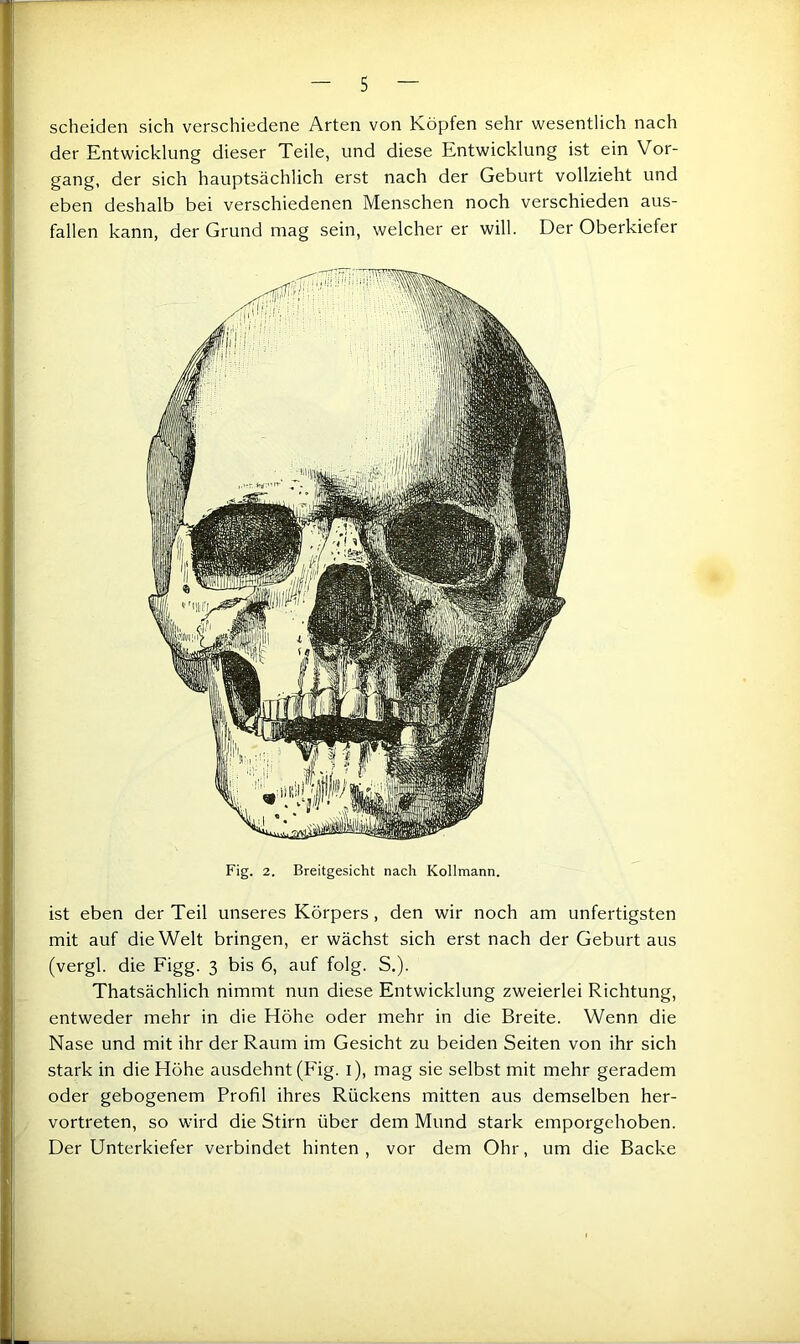 scheiden sich verschiedene Arten von Köpfen sehr wesentlich nach der Entwicklung dieser Teile, und diese Entwicklung ist ein Vor- gang, der sich hauptsächlich erst nach der Geburt vollzieht und eben deshalb bei verschiedenen Menschen noch verschieden aus- fallen kann, der Grund mag sein, welcher er will. Der Oberkiefer Fig. 2. Breitgesicht nach Kollmann. ist eben der Teil unseres Körpers, den wir noch am unfertigsten mit auf die Welt bringen, erwächst sich erst nach der Geburt aus (vergl. die Figg. 3 bis 6, auf folg. S.). Thatsächlich nimmt nun diese Entwicklung zweierlei Richtung, entweder mehr in die Höhe oder mehr in die Breite. Wenn die Nase und mit ihr der Raum im Gesicht zu beiden Seiten von ihr sich stark in die Höhe ausdehnt (Fig. i), mag sie selbst mit mehr geradem oder gebogenem Profil ihres Rückens mitten aus demselben her- vortreten, so wird die Stirn über dem Mund stark emporgehoben. Der Unterkiefer verbindet hinten, vor dem Ohr, um die Backe