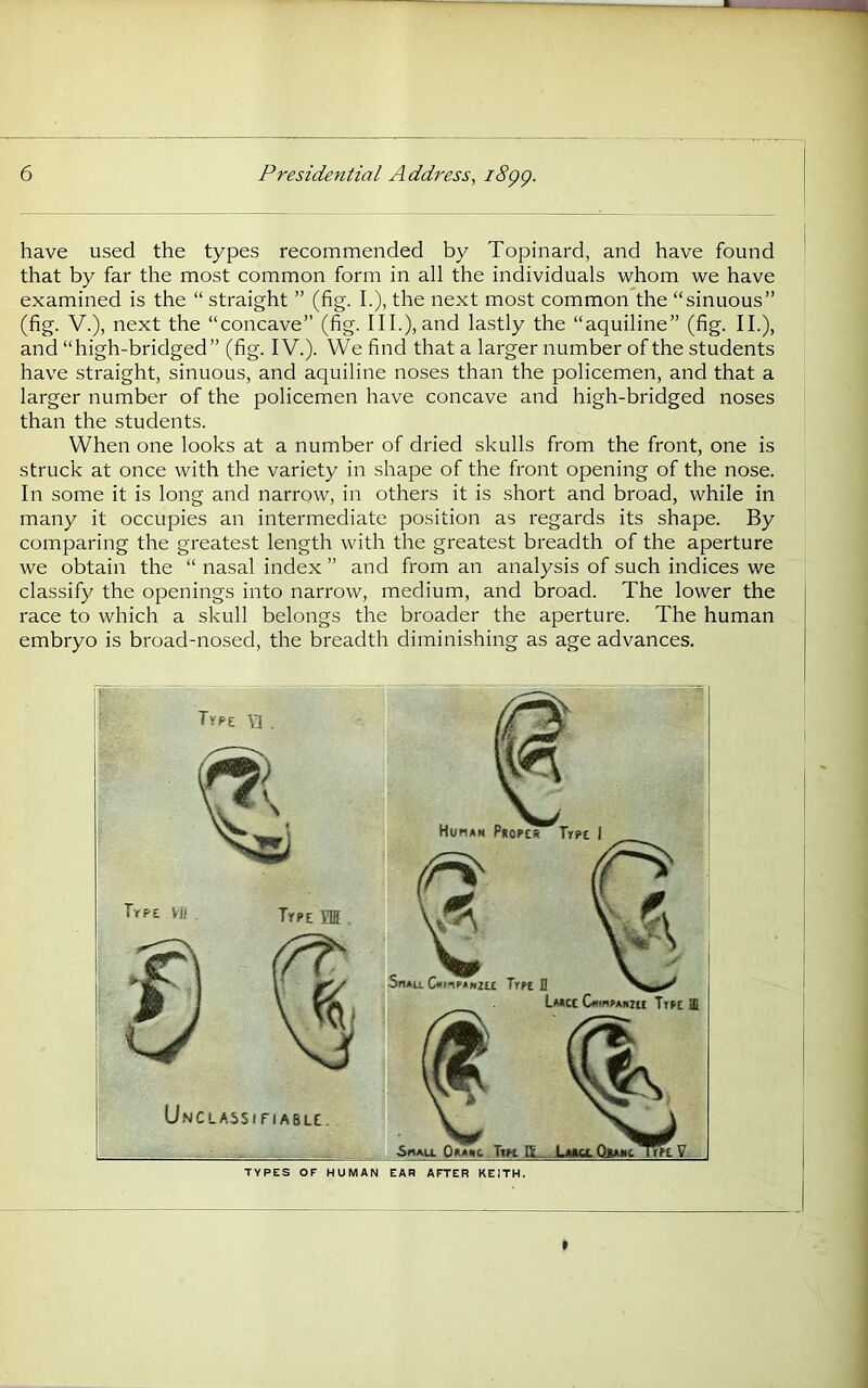 have used the types recommended by Topinard, and have found that by far the most common form in all the individuals whom we have examined is the “ straight ” (fig. I.), the next most common the “sinuous” (fig. V.), next the “concave” (fig. III.), and lastly the “aquiline” (fig. II.), and “high-bridged” (fig. IV.). We find that a larger number of the students have straight, sinuous, and aquiline noses than the policemen, and that a larger number of the policemen have concave and high-bridged noses than the students. When one looks at a number of dried skulls from the front, one is struck at once with the variety in shape of the front opening of the nose. In some it is long and narrow, in others it is short and broad, while in many it occupies an intermediate position as regards its shape. By comparing the greatest length with the greatest breadth of the aperture we obtain the “ nasal index ” and from an analysis of such indices we classify the openings into narrow, medium, and broad. The lower the race to which a skull belongs the broader the aperture. The human embryo is broad-nosed, the breadth diminishing as age advances. TYPES OF HUMAN EAR AFTER KEITH. %