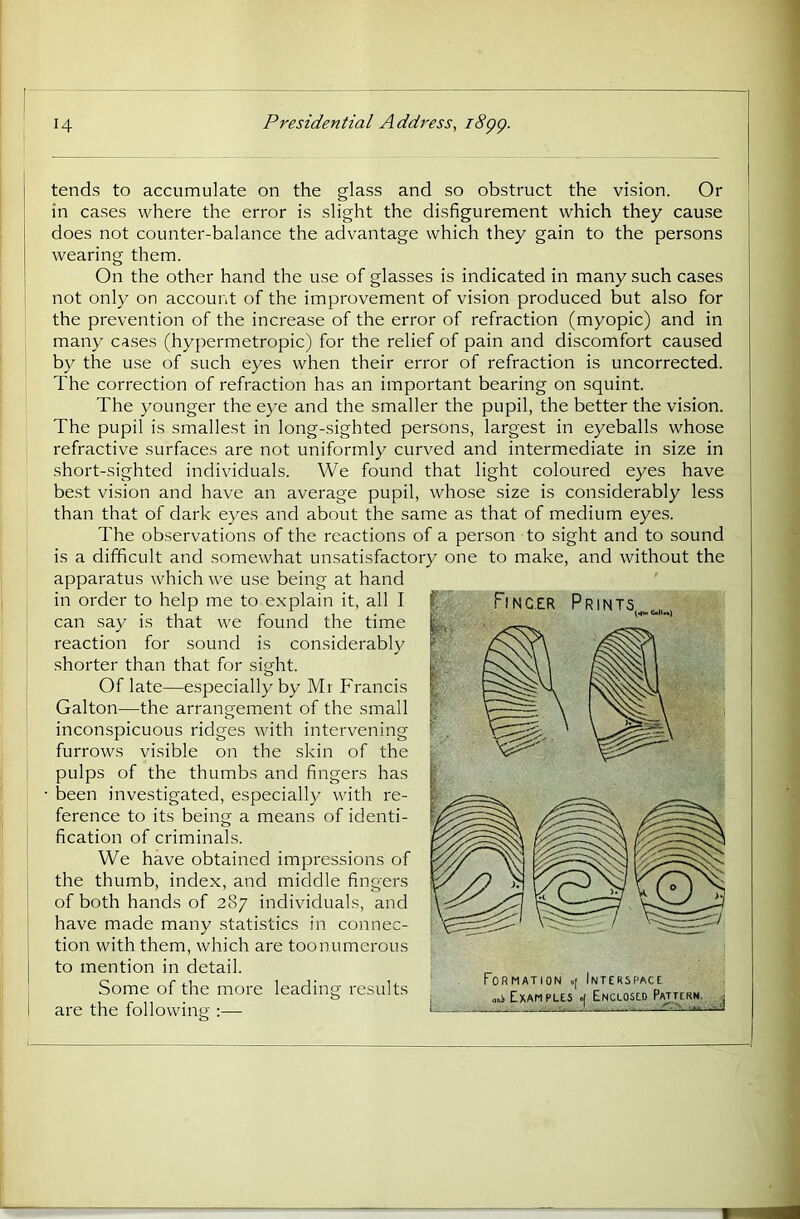 \ tends to accumulate on the glass and so obstruct the vision. Or ' in cases where the error is slight the disfigurement which they cause does not counter-balance the advantage which they gain to the persons wearing them. On the other hand the use of glasses is indicated in many such cases not only on account of the improvement of vision produced but also for the prevention of the increase of the error of refraction (myopic) and in many cases (hypermetropic) for the relief of pain and discomfort caused by the use of such eyes when their error of refraction is uncorrected. The correction of refraction has an important bearing on squint. The younger the eye and the smaller the pupil, the better the vision. The pupil is smallest in long-sighted persons, largest in eyeballs whose refractive surfaces are not uniformly curved and intermediate in size in short-sighted individuals. We found that light coloured eyes have best vision and have an average pupil, whose size is considerably less than that of dark eyes and about the same as that of medium eyes. The observations of the reactions of a person to sight and to sound is a difficult and somewhat unsatisfactory one to make, and without the apparatus which we u.se being at hand in order to help me to explain it, all I can say is that we found the time reaction for sound is considerably shorter than that for sight. Of late—especially by Mr Francis Galton—the arrangement of the small inconspicuous ridges with intervening furrows visible on the skin of the pulps of the thumbs and fingers has • been investigated, especially with re- ference to its being a means of identi- fication of criminals. We have obtained impressions of the thumb, index, and middle fingers of both hands of 287 individuals, and have made many statistics in connec- tion with them, which are toonumerous to mention in detail. Some of the more leading results are the following :—