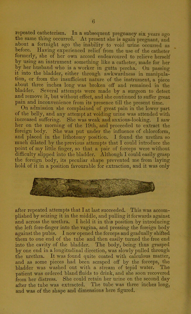 G repeated catheterism. In a subsequent pregnancy six years ago the same tiling occurred. At present she is again pregnant, and about a fortnight ago the inability to void urine occurred as before. Having experienced relief from the use of the catheter formerly, she of her own accord endeavoured to relieve herself by using an instrument something like a catheter, made for her by her husband who is a worker in gutta percha. On passing it into the bladder, either through awkwardness in manipula- tion, or from the insufficient nature of the instrument, a piece about three inches long was broken off and remained in the bladder. Several attempts were made by a surgeon to detect and remove it, but without effect, and she continued to suffer great pain and inconvenience from its presence till the present time. On admission she complained of great pain in the lower part of the belly, and any attempt at voiding urine was attended with increased suffering. She was weak and anxious-looking. I saw her on the morning of the 19th, and proceeded to extract the foreign body. She was put under the influence of chloroform, and placed in the lithotomy position. I found the urethra so much dilated by the previous attempts that I could introduce the point of my little finger, so that a pair of forceps were without difficulty slipped into the bladder. Although I could easily grasp the foreign body, its peculiar shape prevented me from laying hold of it in a position favourable for extraction, and it was only after repeated attempts that I at last succeeded. This was accom- plished by seizing it in the middle, and pulling it forwards against and across the urethra. I held it in this position by introducing the left fore-finger into the vagina, and pressing the foreign body against the pubis. I now opened the forceps and gradually shifted them to one end of the tube and then easily turned the free end into the cavity of the bladder. The body, being thus grasped by one end in a longitudinal direction, was slowly pulled through the urethra. It was found quite coated with calculous matter, and as some pieces had been scraped off by the forceps, the bladder was washed out with a stream of tepid water. The patient was ordered bland fluids to drink, and she soon recovered from her distress. She could retain her urine on the second day after the tube was extracted. The tube was three inches long, and was of the shape and dimensions here figured.