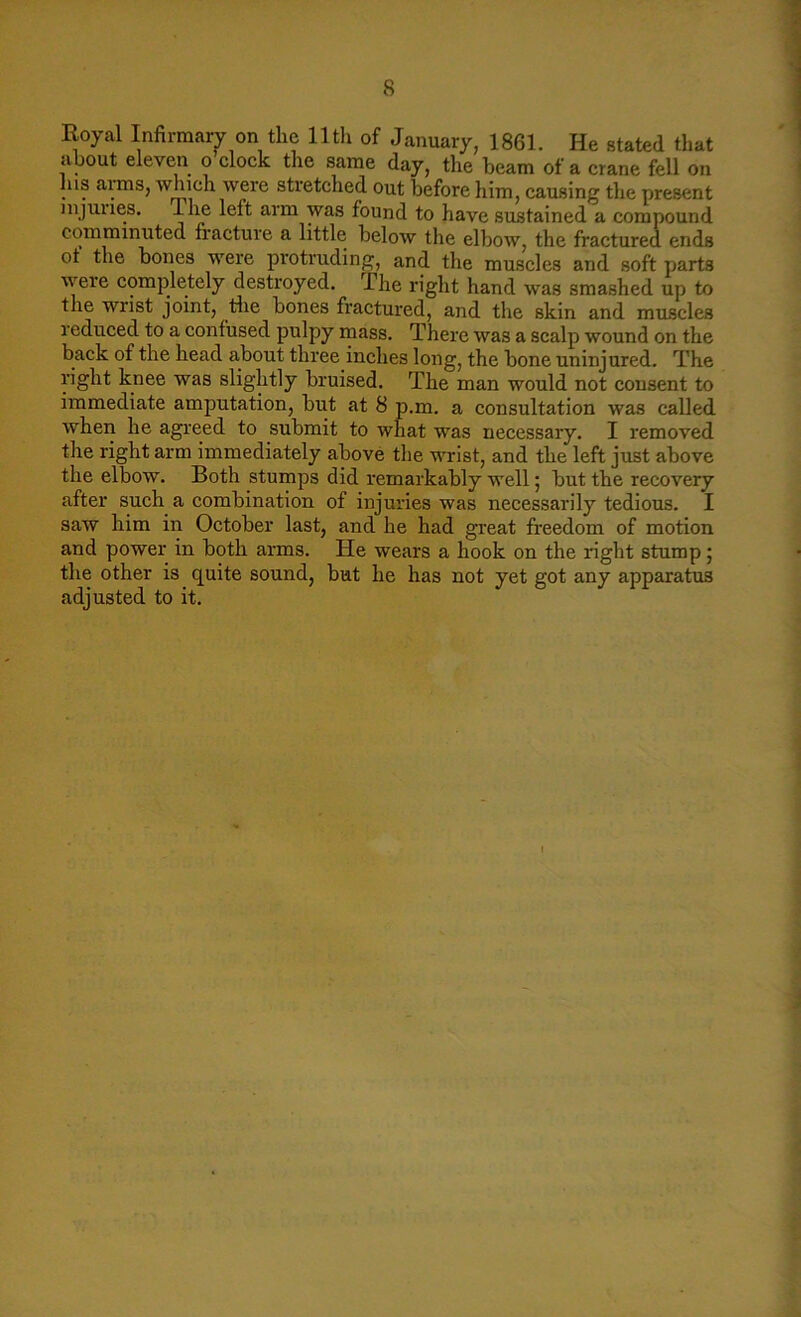 Royal Infirmary on the 11th of January, 1861. He stated that about eleven o clock the same day, the beam of a crane fell on Ins aims, which were stretched out before him, causing the present mjuues. Jhe left arm was found to have sustained a compound comminuted fracture a little below the elbow, the fractured ends ot the bones were protruding, and the muscles and soft parts weie completely destroyed. I be right hand was smashed up to the wrist joint, the bones fractured, and the skin and muscles reduced to a confused pulpy mass. There was a scalp wound on the back of the head about three inches long, the bone uninjured. The right knee was slightly bruised. The man would not consent to immediate amputation, but at 8 p.m. a consultation was called when he agreed to submit to what was necessary. I removed the right arm immediately above the wrist, and the left just above the elbow. Both stumps did remarkably well; but the recovery after such a combination of injuries was necessarily tedious. I saw him in October last, and he had great freedom of motion and power in both arms. He wears a hook on the right stump; the other is quite sound, but he has not yet got any apparatus adjusted to it.