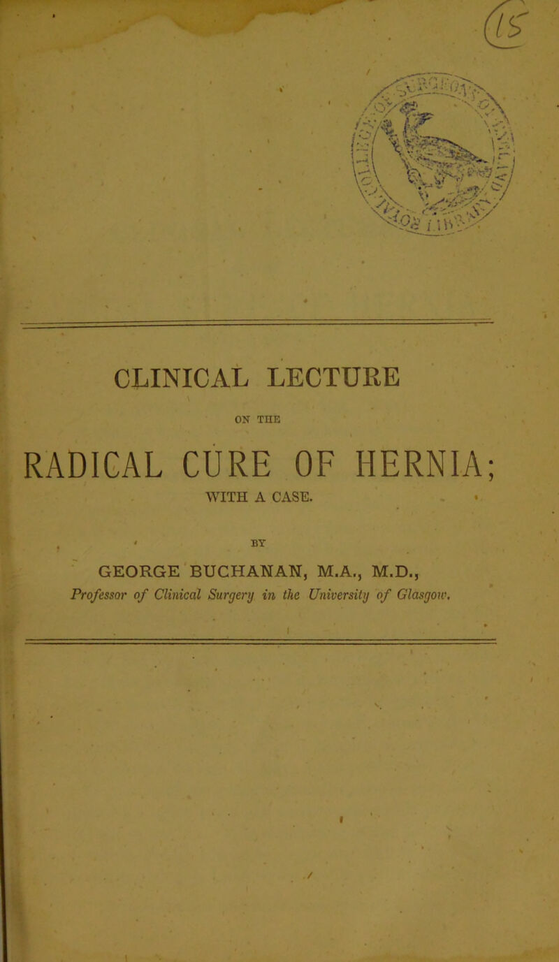 ON THE RADICAL CURE OF HERNIA; WITH A CASE. < BY GEORGE'BUCHANAN, M.A., M.D., Professor of Clinical Surgery in the University of Glasgow,