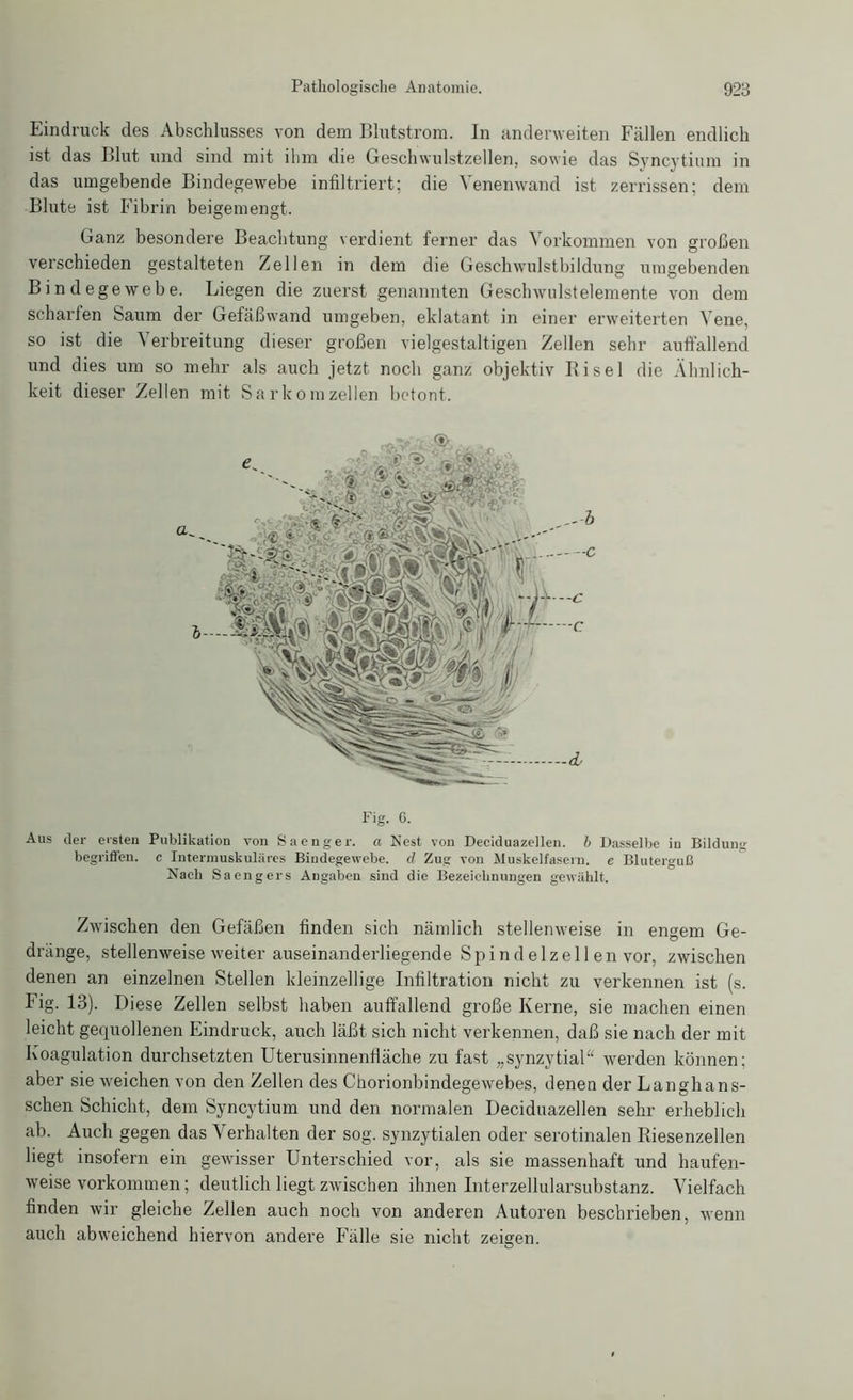 Eindruck des Abschlusses von dem Blutstrom. In anderweiten Fällen endlich ist das Blut und sind mit ihm die Geschwulstzellen, sowie das Syncytium in das umgebende Bindegewebe infiltriert; die Venenwand ist zerrissen; dem Blute ist Fibrin beigemengt. Ganz besondere Beachtung verdient ferner das Vorkommen von großen verschieden gestalteten Zellen in dem die Geschwulstbildung umgebenden Bindegewebe. Liegen die zuerst genannten Geschwulstelemente von dem scharfen Saum der Gefäßwand umgeben, eklatant in einer erweiterten Vene, so ist die Verbreitung dieser großen vielgestaltigen Zellen sehr auffallend und dies um so mehr als auch jetzt noch ganz objektiv Bisei die Ähnlich- keit dieser Zellen mit Sarkom zellen betont. Fig. C. Aus der ersten Publikation von Sa eng er. a Nest von Deciduazellen. b Dasselbe in Bildung begriffen, c Intermuskulärcs Bindegewebe, d Zug von Muskelfasern, e Bluterguß Nach Saengers Angaben sind die Bezeichnungen gewählt. Zwischen den Gefäßen finden sich nämlich stellenweise in engem Ge- dränge, stellenweise weiter auseinanderliegende Spind elzel 1 en vor, zwischen denen an einzelnen Stellen kleinzellige Infiltration nicht zu verkennen ist (s. Fig. 13). Diese Zellen selbst haben auffallend große Kerne, sie machen einen leicht gequollenen Eindruck, auch läßt sich nicht verkennen, daß sie nach der mit Koagulation durchsetzten Uterusinnenfläche zu fast „synzytial“ werden können; aber sie weichen von den Zellen des Chorionbindegewebes, denen der Langhans- schen Schicht, dem Syncytium und den normalen Deciduazellen sehr erheblich ab. Auch gegen das Verhalten der sog. synzytialen oder serotinalen Riesenzellen liegt insofern ein gewisser Unterschied vor, als sie massenhaft und haufen- weise Vorkommen; deutlich liegt zwischen ihnen Interzellularsubstanz. Vielfach finden wir gleiche Zellen auch noch von anderen Autoren beschrieben, wenn auch abweichend hiervon andere Fälle sie nicht zeigen. O