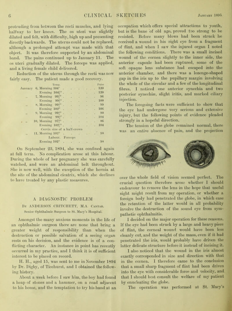 protruding from between the recti muscles, and lying halfway to her knees. The os uteri was slightly dilated and felt, with difficulty, high up and presenting directly backwards. The uterus could not be replaced, although a j^rolonged attempt was made with that object. It was therefore supported by an abdominal band. The pains continued up to January 11. The os uteri gradually dilated. The forceps was applied, and a living female child delivered. Reduction of the uterus through the recti was now fairly easy. The patient made a good recovery. Temp. Pulse .Taiuiaiy 0, Morning 104° ..... 120 Evening 104|° 120 ,. 7, Morning 99|° 96 Evening 99|° 100 8, Morning 994° 99 Evening 102° ..... 106 ,, 9, Morning 99i° ..... 90 Evening 994° ..... 104 10, Morning 97|° 86 Evening 102|° ..... 104 Cervix size of a half-crown ,, 11, Morning 102° . . . . . ’ 98 Labour. Forceps Evening 102° 98 On September 23, 1894, she was confined again at full term. No complication arose at this labour. During the whole of her pregnancy she was carefully watched, and wore an abdominal belt throughout. She is now well, with the exception of the hernia at the site of the abdominal cicatrix, wbich she declines to have treated by any plastic measures. A DIAGNOSTIC PROBLEM By ANDERSON CRITCHETT, M.A. Cantab. Senior Ophthalmic Surgeon to St. Mary’s Hospital. Amongst the many anxious moments in the life of an ophthalmic surgeon there are none that bring a greater weight of responsibility than when the destruction or possible salvation of a seeing organ rests on his decision, and the evidence is of a con- flicting character. An instance in point has recently occurred in my practice, and I think it is of sufficient interest to be placed on record. H. H., aged 15, was sent to me in November 1894 by Dr. Digby, of Ticehurst, and I obtained the follow- ing history. About a week before I saw him, the boy had found a heap of stones and a hammer, on hi road adjacent to his home, and the temptation to try his hand at an occupation which offers special attractions to youth, but is the bane of old age-, proved too strong to be resisted. Before many blows had been struck he received a wound in his right eye from a fragment of flint, and when I saw the injured organ I noted the following conditions. There was a small incised wound of the cornea slightly to the inner side, the anterior capsule had been ruptured, some of the soft opaque lens substance had escaped into the anterior chamber, and there was a lozenge-shaped gap in the iris up to the pupillary margin involving the whole of the circular and a fev; of the longitudinal fibres. I noticed one anterior synechia and two posterior synechiie, slight iritis, and marked ciliary injection. The foregoing facts were sufficient to show that the eye had undergone very serious and extensive injury, but the following points of evidence pleaded strongly in a hopeful direction. The tension of the globe remained normal, there was an entire absence of pain, and the projection over the whole field of vision seemed perfect. The crucial question therefore arose whether I should endeavour to remove the lens in the hope that useful sight might result from my operation, or whether a foreign body had penetrated the globe, in which case the retention of the latter would in all probability involve the destruction of the sound eye from sym- pathetic ophthalmitis. I decided on the major operation for these reasons. If the eye had been struck by a large and heavy piece of flint, the corneal wound would have been less cleanly cut, and the weight of the mass, even if it had penetrated the iris, would probably have driven the latter delicate structure before it instead of incising it. I also noticed that the wound in the iris almost exactly corresponded in size and direction with that in the cornea. I therefore came to the conclusion that a small sharp fragment of flint had been driven into the eye with considerable force and velocity, and that I should best consult the welfare of my patient by enucleating the globe. The operation was performed at St. Mary’s
