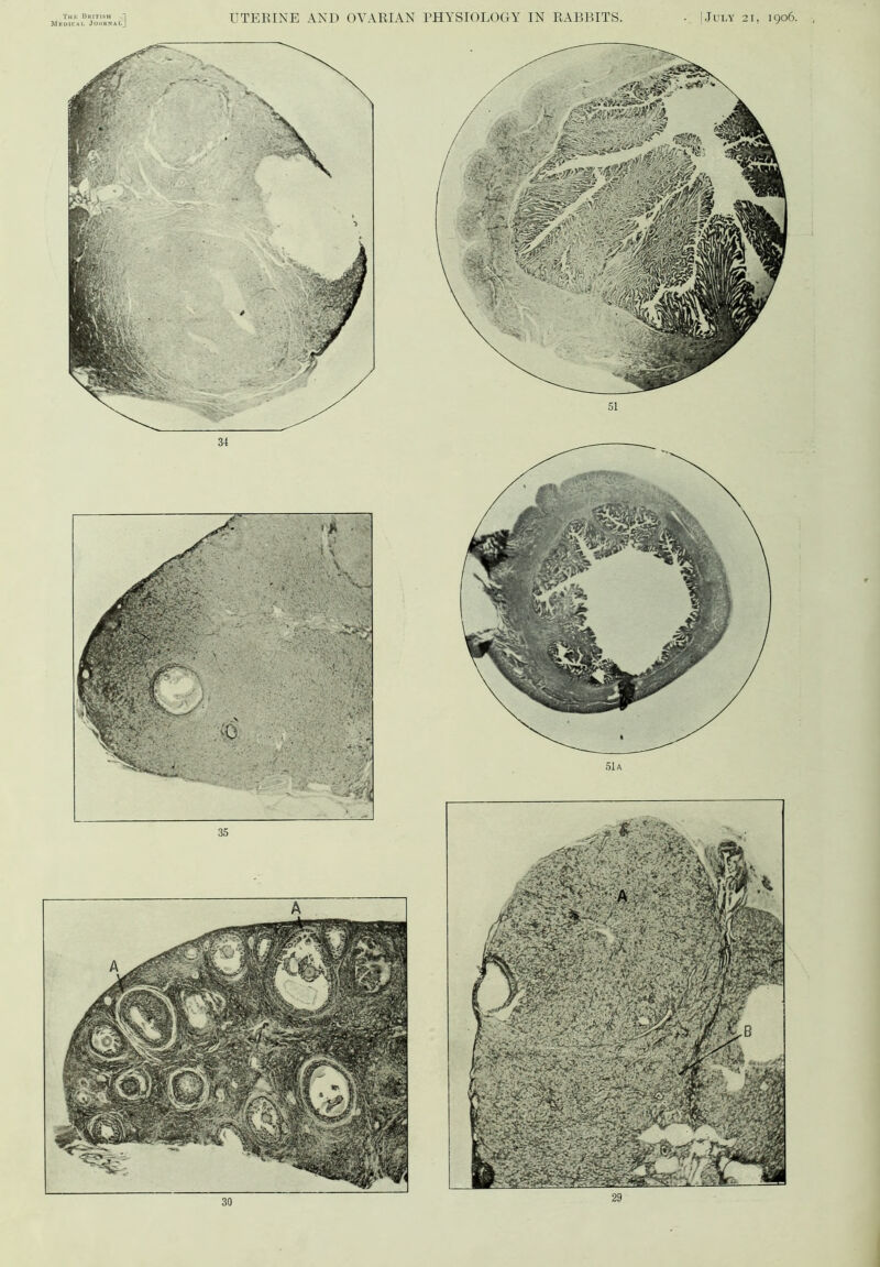 Meuicai. Journal - | July 21, 1906. matm W^m| <* • i X \ ’> ** 3% - • . •