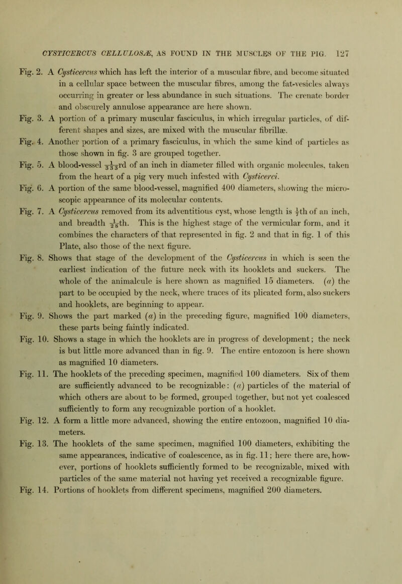 Fig. 2. A Cysticercus which has left the interior of a muscular fibre, and become situated in a cellular space between the muscular fibres, among the fat-vesicles always occurring in greater or less abundance in such situations. The crenate border and obscurely annulose appearance are here shown. Fig. 3. A portion of a primary muscular fasciculus, in which irregular particles, of dif- ferent shapes and sizes, are mixed Avith the muscular fibrillse. Fig. 4. Another portion of a primary fasciculus, in Avhich the same kind of particles as those shown in fig. 3 are grouped together. Fig. 5. A blood-vessel 3-^rd of an inch in diameter filled Avith organic molecules, taken from the heart of a pig very much infested Avith Cysficerd. Fig. 6. A portion of the same blood-vessel, magnified 400 diameters, slioAving the micro- scopic appearance of its molecular contents. Fig. 7. A Cysticercus remoA^ed from its adventitious cyst, Avhose length is yth of an inch, and breadth a^th. This is the highest stage of the vermicular form, and it combines the characters of that represented in fig. 2 and that in fig. 1 of this Plate, also those of the next figure. Fig. 8. ShoAvs that stage of the development of the Cysticercus in Avhich is seen the earliest indication of the future neck Avitli its booklets and suckers. The Avhole of the animalcule is here shoAvn as magnified 15 diameters. («) the part to be occupied by the neck, AA’here traces of its plicated form, also suckers and booklets, are beginning to apjiear. Fig. 9. Shows the part marked {a) in the preceding figure, magnified 100 diameters, these parts being faintly indicated. Fig. 10. Shows a stage in Avhich the booklets are in progress of development; the neck is but little more advanced than in fig. 9. The entire entozoon is here shoAvn as magnified 10 diameters. Fig. 11. The booklets of the preceding specimen, magnified 100 diameters. Six of them are sufficiently advanced to be recognizable: {a) particles of the material of which others are about to be formed, grouped together, but not yet coalesced sufficiently to form any recognizable portion of a booklet. Fig. 12. A form a little more advanced, shoAving the entire entozoon, magnified 10 dia- meters. Fig. 13. The booklets of the same specimen, magnified 100 diameters, exhibiting the same appearances, indicative of coalescence, as in fig. 11; here there are, how- ever, portions of booklets sufficiently formed to be recognizable, mixed with particles of the same material not having yet received a recognizable figure. Fig. 14. Portions of booklets from different specimens, magnified 200 diameters.