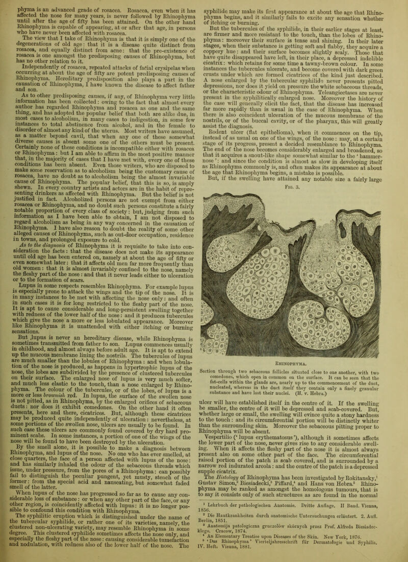 phyma is an advanced grade of rosacea. Eosacea, even when it has affected the nose for many years, is never followed by Ehinophyma until after the age of fifty has been attained. On the other hand Ehinophyma is capable of appearing, at or after that age, in persons who have never been affected with rosacea. The view that I take of Ehinophyma is that it is simply one of the degenerations of old age: that it is a disease quite distinct from rosacea, and equally distinct from acne: that the pre-existence of rosacea is one amongst the predisposing causes of Ehinophyma, but has no other relation to it. Independently of rosacea, repeated attacks of facial erysipelas when occurring at about the age of fifty are potent predisposing causes of Ehinophyma. Hereditary predi.S2)osition also i)lays a 2in-rt in the causation of Ehinophyma, I have known the disease to affect father and son. As to other predis2)osing causes, if any, of Ehinophyma very little information has been collected: owing to the fact that almost every author has regarded Ehino2ihyma and rosacea as one and the same tiling, and has ado2ited the po2iular belief that both are alike due, in most cases to alcoholism, in many cases to indigestion, in some few instances to total abstinence from alcohol, and in the female to disorder of almost any kind of the uterus. Most writers have assumed, as a matter beyond cavil, that when any one of these somewhat diverse causes is absent some one of the others must be 2ircsent. Certainly none of these conditions is incom2iatible either with rosacea I ^ble to affirm in the most 2)Ositive manner that, in the majority of cases that I have met with, every one of these conditions has been absent. Even those writers, who are disposed to make some reservation as to alcoholism being the customary cause of rosacea, have no doubt as to alcoholism being the almost invariable cause of Ehino2ihyma. The po2iular belief, that this is so, is am2ily shewn. In every country artists and actors are in the habit of repre- senting drinkers as affected with Ehino2ihyma. But the belief is not justified in fact. Alcoholized persons are not exem2it from either rosacea or Ehinophyma, and no doubt such 2i6rsons constitute a fairly nffiable proportion of every class of society: but, judging from such mformation as I have been able to obtain, I am not disposed to regard alcoholism as being in any way concerned in the causation of Ehinophyma. I have also reason to doubt the reality of some other alleged causes of Ehino2ihyma, such as out-door occupation, residence in towns, and prolonged exjxisure to cold. As to the diagnosis of Ehinophyma it is requisite to take into con- sideration the facts: that the disease does not make its appearance until old age has been entered on, namely at about the age of fifty or even somewhat later: that it affects old men far more frequently than old women: that it is almost invariably confined to the nose, namely the fleshy part of the nose : and that it never leads either to ulceration or to the formation of scars. Lupus in some respects resembles Ehinophyma. For example lupus IS especially prone to attack the wings and the tip of the nose. It is in many instances to be met with affecting the nose only: and often in such cases it is for long restricted to the fleshy part of the nose. It is apt to cause considerable and long-persistent swelling together with redness of the lower half of the nose; and it produces tubercules which give the nose a more or less lobulated appearance. Moreover like Ehinophyma it is unattended with either itching or burning sensations. But lupus is never an hereditary disease, while Ehinophyma is sometimes transmitted from father to son. Lupus commences usually in childhood, and almost always before adult age. It is apt to extend up the mucous membrane lining the nostrils. The tubercules of lupus are much smaller than the lobules of Ehinophyma : and when lobula- tion of the nose is produced, as happens in hypertrophic lupus of the nose, the lobes are subdivided by the presence of clustered tubercules on their surface. The enlarged nose of lupus is very much softer, and much less elastic to the touch, than a nose enlarged by Ehino- phyma. The colour of the tubercules, or of the lobes, of lupus is a more or less brownish red. In lupus, the surface of the swollen nose is not pitted, as in Ehinophyma, by the enlarged orifices of sebaceous ducts: nor does it exhibit comedones. On the other hand it often presents, here and there, cicatrices. But, although these cicatrices may be produced quite independently of ulceration: nevertheless, at some portions of the swollen nose, ulcers are usually to be found. In such case these ulcers are commonly found covered by dry hard pro- minent scabs. In some instances, a portion of one of the wings of the nose will be found to have been destroyed by the.ulceration. By the smell alone, it is possible to make a diagnosis between Ehinophyma, and lupus of the nose. No one who has ever smelled, at close quarters, the face of a person affected with lupus of the nose: and has similarly inhaled the odour of the sebaceous threads which issue, under pressure, from the pores of a Ehinophyma; can possibly fail to distinguish the peculiar pungent, yet musty, stench of the former: from the special acid and nauseating, but somewhat faded smell of the latter. \Vhen lupus of the nose has progressed so far as to cause any con- siderable loss of substance : or when any other part of the face, or any other region, is coincidently affected with lupus c it is no longer pos- sible to confound this condition with Ehinophyma. The syphilitic eruption which is distinguished under the name of the tubercular syphilide, or rather one of its varieties, namely the clustered non-ulcerating variety, may resemble Ehinophyma in some degree. This clustered syphilide sometimes affects the nose only, and especially the fleshy part of the nose: causing considerable tumefaction and nodulation, with redness also of the lower half of the nose. The syphilide may make its first appearance at about the age that Ehino- phyma begins, and it similarly fails to excite any sensation whether of itching or burning. But the tubercules of the syphilide, in their earlier stages at least, are firmer and more resistant to the touch, than the lobes of Ehino- phyma : moreover their surface is tense and shining. In their later stages, when their substance is getting soft and flabby, they acquire a coppery hue: and their surface becomes slightly scaly. Those that have quite disa2)peared have left, in their place, a depressed indelible cicatrix: which retains for some time a tawny-brown colour. In some instances the tubercules ulcerate, and become covered with dark green crusts under which are formed cicatrices of the kind just described. A nose enlarged by the tubercular syphilide never presents pitted depressions, nor does it yield on pressure the white sebaceous threads, or the characteristic odour of Ehino2)hyma. Teleangiectases are never in-esent in the sy2ffiilitically enlarged nose. Moreover the history of the case will generally elicit the fact, that the disease has increased far more rapidly than is usual in the case of Ehinophyma. When there is also coincident ulceration of the mucous membrane of the nostrils, or of the buccal cavity, or of the pharynx, this will greatly assist the diagnosis. Eodent ulcer (flat epithelioma), when it commences on the tip, instead of as usual on one of the wings, of the nose: may, at a certain stage of its progress, present a decided resemblance to Ehino2)hyma. The end of the nose becomes considerably enlarged and broadened, so that it acquires a snout-like shape somewhat similar to the ‘ hammer- nose’: and since the condition is almost as slow in developing itself as Ehinophyma commonly is, and often makes its appearance at about the age that Ehinophyma begins, a mistake is possible. But, if the swelling have attained any notable size a fairly large Fig. 3. Rhinopiiyma. Section through two sebaceous follicles situated close to one another, with two comedones, which open in common on the surface. It can be seen that the fat-cells within the glands are, nearly up to the commencement of the duct, nucleated, whereas in the duct itself they contain only a finely granular substance and have lost their nuclei. (H. v. Hebra.) ulcer will have established itself in the centre of it. If the swelling be smaller, the centre of it will be depressed and scab-covered. But, whether large or small, the swelling will evince quite a stony hardness to the touch : and its circumferential portion will be distinctly whiter than the surrounding skin. Moreover the sebaceous pitting pro2Jer to Ehinophyma will be absent. Vespertilio (‘ lupus erythematosus ’), although it sometimes affects the lower part of the nose, never gives rise to any considerable swell- ing. When it affects the fleshy 2)art of the nose it is almost always present also on some other part of the face. The circumferential raised portion of the patch is scab covered, and is surrounded by a narrow red indurated areola : and the centre of the patch is a de23ressed supple cicatrix. The Histology of Ehinophyma has been investigated by Eokitansky,' Gustav Simon,^ Biesiadecki,^ Piffard,^ and Hans von Hebra.® Ehino- phyma may be ranked as amongst the homologous tumours, that is to say it consists only of such structures as are found in the normal ’ Lehi-buch der pathologischen Anatomie. Dritte Auflage. II Band. Vienna, 1856. ^ Die Hautkrankheiten durch anatomische Untersuchungen erlautert. 2. Aufl. Berlin, 1851. ^ ^ Auatomija patologiczna gruczolow skornych przez Prof. Alfreda Biesiadec- kicgo. Cracow, 1874. ■* An Elementary Treatise upon Diseases of the Skin. New York, 1876. * ‘ Das Ehinophyma ’ Vierteljahresschrift fur Dermatologie und Syphilis. IV. Hefti Vienna, 1881.