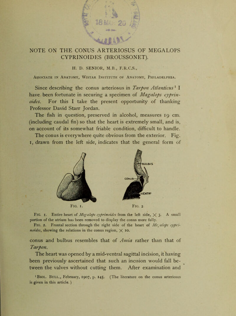 k NOTE ON THE CONUS ARTERIOSUS OF MEGALOPS CYPRINOIDES (BROUSSONET). H. D. SENIOR, M.B., F.R.C.S., Associate in Anatomy, Wistar Institute of Anatomy, Philadelphia. Since describing the conus arteriosus in Tarpon Atlanticus 1 I have been fortunate in securing a specimen of Magalops cjpriu- oides. For this I take the present opportunity of thanking Professor David Starr Jordan. The fish in question, preserved in alcohol, measures 19 cm. (including caudal fin) so that the heart is extremely small, and is, on account of its somewhat friable condition, difficult to handle. The conus is everywhere quite obvious from the exterior. Fig. I, drawn from the left side, indicates that the general form of Fig. 1. Fig. 2 Fig. 1. Entire heart of Megalops cyprinoides from the left side, X 3- A small portion of the atrium has been removed to display the conus more fully. Fig. 2. Frontal section through the right side of the heart of Me^alops cypri- noides, showing the relations in the conus region, X IO- conus and bulbus resembles that of Amia rather than that of Tarpon. The heart was opened by a mid-ventral sagittal incision, it having been previously ascertained that such an incision would fall be- tween the valves without cutting them. After examination and ‘Biol. Bull., February, 1907, p. 145. (The literature on the conus arteriosus is given in this article. )