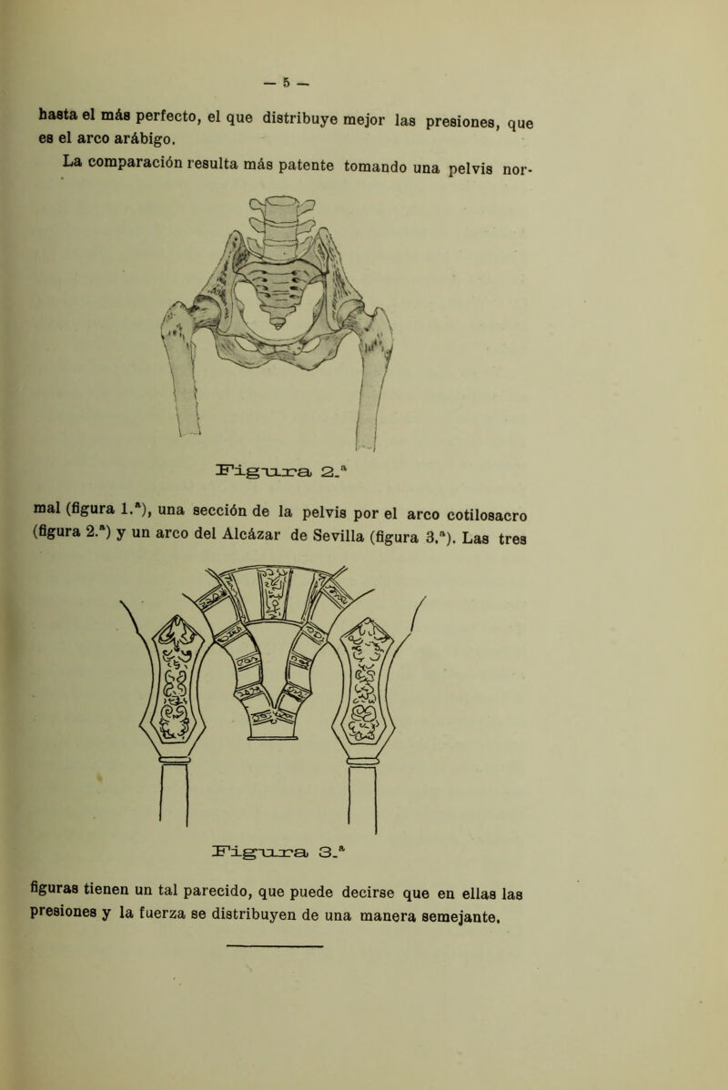 hasta el más perfecto, el que distribuye mejor las presiones, que es el arco arábigo. La comparación resulta más patente tomando una pelvis nor- mal (figura 1. ), una sección de la pelvis por el arco cotilosacro (figura 2.*) y un arco del Alcázar de Sevilla (figura 3.*). Las tres figuras tienen un tal parecido, que puede decirse que en ellas las presiones y la fuerza se distribuyen de una manera semejante.
