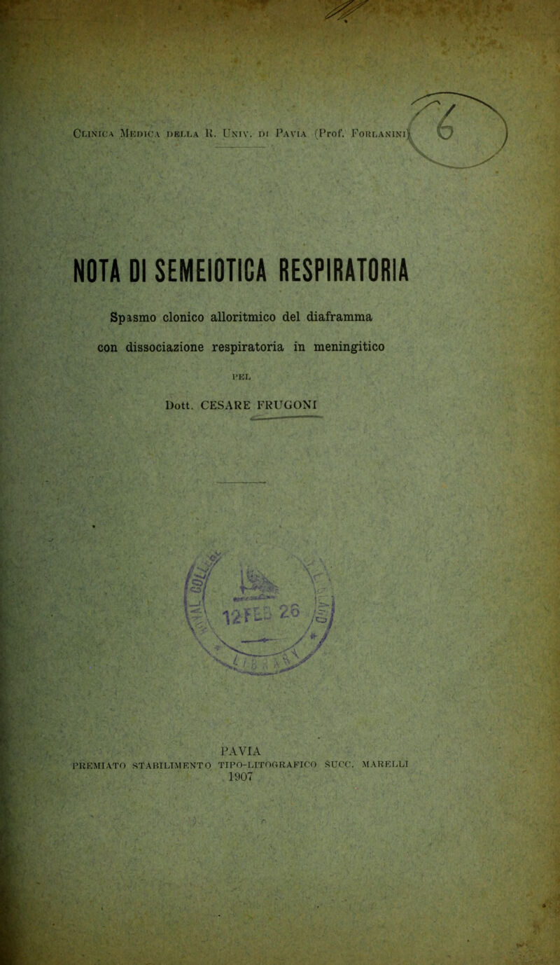 NOTA DI SEMEIOTICA RESPIRATORIA Spasmo clonico alloritmico del diaframma con dissociazione respiratoria in meningitico l’KD Dott. CESARE FRUGONI ■ijt V JWVIA STABILTMKNTO TIPO-LITOGRAFICO SUCC. MARFLLI 1907 PREMIATO