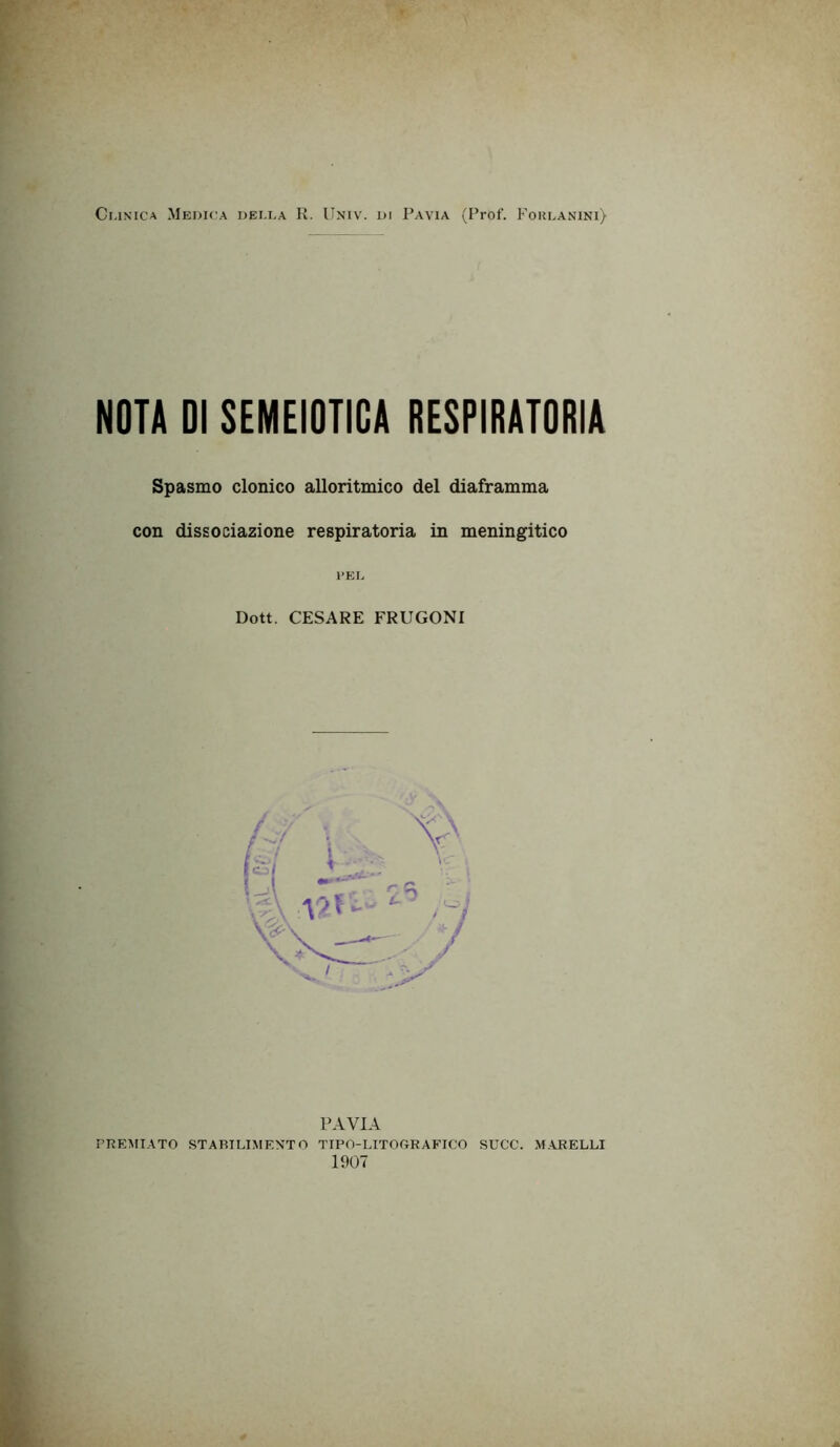 NOTA DI SEMEIOTICA RESPIRATORIA Spasmo clonico alloritmico del diaframma con dissociazione respiratoria in meningitico l'EL Dott. CESARE FRUGONI PAVIA PREMIATO STABILIMENTO TIPO-LITOGRAFICO SUCC. MARELLI 1907