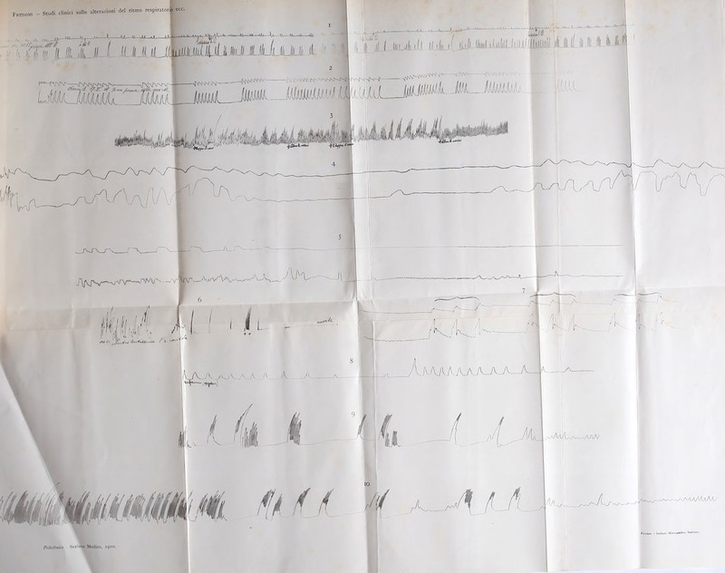 Frugoni - Studi clinici sulle alterazioni, del ritmo respiratori ecc. N if'N'N' N'n^iNjV-JS^ !('”]] ( (iCA-dl LiàaGM-^ —v;; ifl • ,\sn > (tM I00LM— ^aaa/VWU/ Piienze - litituto Mierogmfico Italiano.