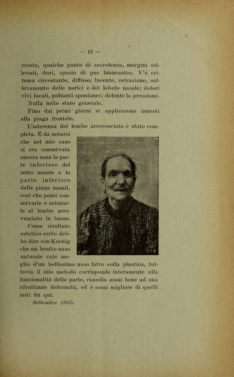 crosta, qualche punto di succolenza, margini sol- levati, duri, spazio di pus biancastro. V’è eri- tema circostante, diffuso, lucente, retrazione, sol- levamento delle narici e del lobulo nasale; dolori vivi locali, pulsanti spontanei: dolente la pressione. l^ulla nello stato generale. Fino dai primi giorni si applicarono innesti alla piaga frontale. L’aderenza del lembo arrovesciato è stato com- pleta. É da notarsi che nel mio caso si era conservata ancora sana la par- te inferiore del setto nasale e la parte inferiore delle pinne nasali, così che potei con- servarle e suturar- le al lembo arro- vesciato in basso. Come risultato estetico certo deb- bo dire conKoenig che un brutto naso naturale vale me- glio d’un bellissimo naso fatto colla plastica, tut- tavia il mio metodo corrisponde interamente alla funzionalità della parte, rimedia assai bene ad una ributtante deformità, ed è assai migliore di quelli noti fin qui. Settembre 1905.