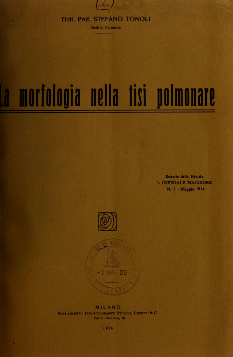 {&) Dott. Ppof. STEFANO TONOLI Medico Primario re Estratto della Rivista L OSPEDALE MAGGIORE N. 5 - Maggio 1914 MILANO Staìilimento Tipo-Litoorafico Stucchi, Ceretti C. Via S. Damiano, 16