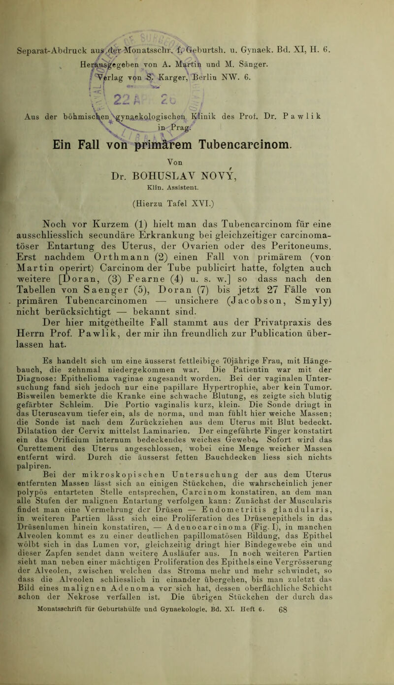 Separat-Abdruck aus.der Monatssclir. f. Geburtsh. u. Gynaek. Bd. XI, H. Herausgegeben von A. Martin und M. Sanger. Verlag von S. Karger, Berliu NW. 6. r-* « ' ~ £ CKs Aus der bohmischen ^yn^ekolo gischen Klinik des Prof. Dr. Pawlik in Prag. 6. Em Fall von primarem Tubencarcinom. Von Dr. BOHUSLAV NOVY, Klin. Assistent. (Hierzu Tafel XVI.) Noch vor Kurzem (1) liielt man das Tubencarcinom fiir eine ausschliesslich secundare Erkrankung bei gleickzeitiger carcinoma- toser Entartung des Uterus, der Ovarien oder des Peritoneums. Erst nacbdem Orthmann (2) einen Fall von primarem (von Martin operirt) Carcinom der Tube publicirt liatte, folgten aucb weitere [Doran, (3) Fearne (4) u. s. w.] so dass nach den Tabellen von Saenger (5), Doran (7) bis jetzt 27 Falle von primaren Tubencarcinomen — unsichere (Jacobson, Smyly) nicbt beriicksichtigt — bekannt sind. Der hier mitgetheilte Fall stammt aus der Privatpraxis des Herrn Prof. Pawlik, der mir ilm freundlich zur Publication uber- lassen hat. Es handelt sich um eine iiusserst fettleibige 70jahrige Frau, mit Hange- bauch, die zehnraal niedergekommen war. Die Patientin war mit der Diagnose: Epithelioma vaginae zugesandt worden. Bei der vaginalen Unter- suckung fand sich jedoch nur eine papillare Hypertrophie, aber kein Tumor. Bisweilen bemerkte die Ivranke eine schwache Blutung, es zeigte sich blutig gefiirbter Schleim. Die Portio vaginalis kurz, klein. Die Sonde driugt in das Uteruscavum tieferein, als de norma, und man fiihlt hier weiche Massen; die Sonde ist nach dem Zuriickziehen aus dem Uterus mit Blut bedeckt. Dilatation der Cervix mittelst Laminarien. Der eingefiihrte Finger konstatirt ein das Orificium internum bedeckendes weiches Gewebe. Sofort wird das Curettement des Uterus angeschlossen, wobei eine Menge weicher Massen entfernt wird. Durch die iiusserst fetten Bauchdecken liess sich niclits palpiren. Bei der mikroskopi schen Untersuchung der aus dem Uterus entfernten Massen liisst sich an einigen Stiickchen, die wahrscheinlich jener polypos entarteten Stelle entsprecken, Carcinom konstatiren, an dem man alle Stufen der malignen Entartung verfolgen kann: Zunachst der Muscularis findet man eine Vermehrung der Driisen — Endometritis glandularis, in weiteren Partien lasst sich eine Proliferation des Driiseuepithels in das Drusenlumen hinein konstatiren, — Adenocarcinoma (Fig. I), in manchen Alveolen kommt es zu einer deutlichen papillomatosen Bildung, das Epithel wolbt sich in das Lumen vor, gleichzeilig dringt hier Bindegewebe ein und dieser Zapfen sendet dann weitere Auslaufer aus. In noch weiteren Partien sieht man neben einer miichtigen Proliferation des Epithels eine Vergrosserung der Alveolen, zwischen welchen das Stroma mehr und mehr schwindet, so dass die Alveolen schliesslich in einander iibergehen, bis man zuletzt das Bild eines malignen Adenoma vor sich hat, dessen oberflachliche Schicht schon der Nekrose verfallen ist. Die ubrigen Stiickchen der durch das Monatsschrift fiir Geburtshiilfe und Gynaekologie, Bd. XI. Heft 6. 68