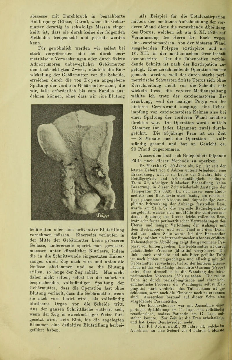 abscesse mit Durchbruch in benachbarte Hohlorgange (Blase, Darm), wenn die Gebär- mutter derartig in schwielige Massen einge- keilt ist, dass sie durch keine der folgenden Methoden freigemacht und gestielt werden kann. Für gewöhnlich werden wir selbst bei stark vergrösserter oder bei durch peri- metritische Verwachsungen oder durch fixirte Adnextumoren unbeweglicher Gebärmutter den beabsichtigten Zweck, nämlich die Ent- wickelung der Gebärmutter vor die Scheide, erreichen durch die von Doyen angegebene Spaltung der vorderen Gebärmutterwand, die wir, falls erforderlich bis zum Fundus aus- dehnen können, ohne dass wir eine Blutung befürchten oder eine präventive Blutstillung vornehmen müssen. Einerseits verlaufen in der Mitte der Gebärmutter keine grösseren Gefässe, andererseits operirt man gewisser- maassen unter künstlicher Blutleere, indem die in die Schnittwunde eingesetzten Haken- zangen durch Zug nach vorn und unten die Gefässe abklemmen und so die Blutung stillen, so lange der Zug anhält. Man sieht daher nicht selten, selbst bei der sofort zu besprechenden vollständigen Spaltung der Gebärmutter, dass die Operation fast ohne Blutung verläuft, dass die Gebärmutter, wenn sie nach vorn luxirt wird, als vollständig blutleeres Organ vor die Scheide tritt. Aus der ganzen Schnittfläche entleert sich, wenn der Zug in zweckmässiger Weise fort- gesetzt wird, kein Blut, bis die angelegten Klemmen eine definitive Blutstillung herbei- geführt haben. Als Beispiel für die Totalexstirpation mittels der medianen Aufschneidung der vor- deren Wand diene die vorstehende Abbildung des Uterus, welchen ich am 5. XI. 1896 auf Veranlassung des Herrn Dr. Bock wegen eines carcinomatösen, von der hinteren Wand ausgehenden Polypen exstirpirte und am 16. XII. in der medicinischen Gesellschaft demonstrirte. Der die Tubenostien verbin- dende Schnitt ist nach der Exstirpation zu- gefügt. Eine zerschneidende Operation musste gemacht werden, weil der durch starke peri- metritische Schwarten fixirte Uterus sich ohne Zerschneidung nicht vor die Scheide ent- wickeln liess, die vordere Medianspaltung wählte ich trotz der carcinomatösen Er- krankung, weil der maligne Polyp von der hinteren Cervixwand ausging, eine Ueber- impfung von carcinomatösen Keimen also bei einer Spaltung der vorderen Wand nicht zu fürchten war. Die Operation wurde mittels Klemmen (an jedes Ligament zwei) durch- geführt. Die 45jährige Frau ist zur Zeit — 8 Monate nach der Operation — voll- ständig gesund und hat an Gewicht ca. 20 Pfund zugenommen. Ausserdem hatte ich Gelegenheit folgende Fälle nach dieser Methode zu operiren: Fr. Martha G., 30 Jahre alt, 6 p., ist seit der letzten Gebart vor 3 Jahren unterleibsleidend, eine Erkrankung, welche im Laufe der 3 Jahre häufig Bettlägrigkeit und Arbeitsunfähigkeit bedingte. Trotz 3 */3 wöchiger klinischer Behandlung keine Besserung, in dieser Zeit wiederholt Ansteigen der Temperatur (bis 38,8). Da sich ausser einer Endo- metritis und Retroflexio uteri fixata, ein rechtssei- tiger parametraner Abscess und doppelseitige com- plicirte Erkrankung der Anhänge feststellen liess, wurde am 21. 4. 97 die vaginale Radicaloperation ausgefiibrt, welche sich mit Hülfe der vorderen me- dianen Spaltung des Uterus leicht vollenden liess, trotz sehr fester perimetritischer Verwachsungen des Uterus und inniger Verlöthung der Anhänge mit dem Beckenboden und zum Theil mit dem Darm. Auf der linken Seite wurde bei der Enucleation der Pyosalpinx ein intraperitonealer Abscess eröffnet. Nebenstehende Abbildung zeigt das gewonnene Prä- parat von hinten gesehen. Die Gebärmutter ist durch entzündliche Processe (Metritis) vergrössert. Die linke stark verdickte und mit Eiter gefüllte Tube ist nach hinten umgeschlagen und allseitig mit der Gebärmutter verwachsen, tief an der hinteren Uterus- fläche ist das vollständig abscedirte Ovarium (Pyoov) fixirt, über demselben ist die Wandung des intra- peritonealen Abscesses (Ab) zu sehen. Die rechte Tube ist durch perisalpingitische und chronisch- entzündliche Processe der Wandungen selbst (Sal- pingitis) stark verdickt, das Tubenostium ist ge- schlossen, wenn auch die Fimbrien noch zu erkennen sind. Ausserdem bestand auf dieser Seite eine ausgedehnte Parametritis. Die Reeonvalescenz war mit Ausnahme einer geringen Spätblutung am 11. Tage eine vollständig reaetionslose, sodass Patientin am 17. Tage auf- j stehen konnte. Zur Zeit ist die Frau arbeitsfähig, und hat keine Beschwerden mehr. Bei Frl. Johanna M., 33 Jahre alt, welche im t Anschluss an eine Geburt vor 4 Jahren 4 Monate