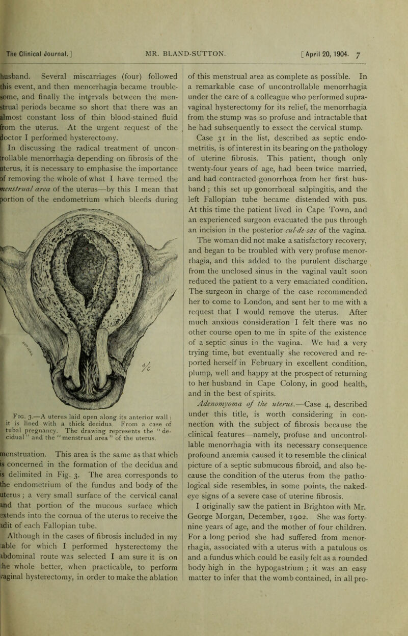 husband. Several miscarriages (four) followed this event, and then menorrhagia became trouble- some, and finally the intervals between the men- strual periods became so short that there was an almost constant loss of thin blood-stained fluid from the uterus. At the urgent request of the doctor I performed hysterectomy. [ In discussing the radical treatment of uncon- trollable menorrhagia depending on fibrosis of the uterus, it is necessary to emphasise the importance of removing the whole of what I have termed the menstrual area of the uterus—by this I mean that portion of the endometrium which bleeds during menstruation. This area is the same as that which is concerned in the formation of the decidua and is delimited in Fig. 3. The area corresponds to the endometrium of the fundus and body of the uterus; a very small surface of the cervical canal and that portion of the mucous surface which extends into the cornua of the uterus to receive the adit of each Fallopian tube. Although in the cases of fibrosis included in my able for which I performed hysterectomy the abdominal route was selected I am sure it is on he whole better, when practicable, to perform /aginal hysterectomy, in order to make the ablation of this menstrual area as complete as possible. In a remarkable case of uncontrollable menorrhagia under the care of a colleague who performed supra- vaginal hysterectomy for its relief, the menorrhagia from the stump was so profuse and intractable that he had subsequently to exsect the cervical stump. Case 31 in the list, described as septic endo- metritis, is of interest in its bearing on the pathology of uterine fibrosis. This patient, though only twenty-four years of age, had been twice married, and had contracted gonorrhoea from her first hus- band ; this set up gonorrhoeal salpingitis, and the left Fallopian tube became distended with pus. At this time the patient lived in Cape Town, and an experienced surgeon evacuated the pus through an incision in the posterior cul-de-sac of the vagina. The woman did not make a satisfactory recovery, and began to be troubled with very profuse menor- rhagia, and this added to the purulent discharge from the unclosed sinus in the vaginal vault soon reduced the patient to a very emaciated condition. The surgeon in charge of the case recommended her to come to London, and sent her to me with a request that I would remove the uterus. After much anxious consideration I felt there was no other course open to me in spite of the existence of a septic sinus in the vagina. We had a very trying time, but eventually she recovered and re- ported herself in February in excellent condition, plump, well and happy at the prospect of returning to her husband in Cape Colony, in good health, and in the best of spirits. Adetio??iyoma of the uterus.—Case 4, described under this title, is worth considering in con- nection with the subject of fibrosis because the clinical features—namely, profuse and uncontrol- lable menorrhagia with its necessary consequence profound anaemia caused it to resemble the clinical picture of a septic submucous fibroid, and also be- | cause the condition of the uterus from the patho- logical side resembles, in some points, the naked- eye signs of a severe case of uterine fibrosis. I originally saw the patient in Brighton with Mr. George Morgan, December, 1902. She was forty- nine years of age, and the mother of four children. For a long period she had suffered from menor- rhagia, associated with a uterus with a patulous os and a fundus which could be easily felt as a rounded body high in the hypogastrium ; it was an easy matter to infer that the womb contained, in all pro-