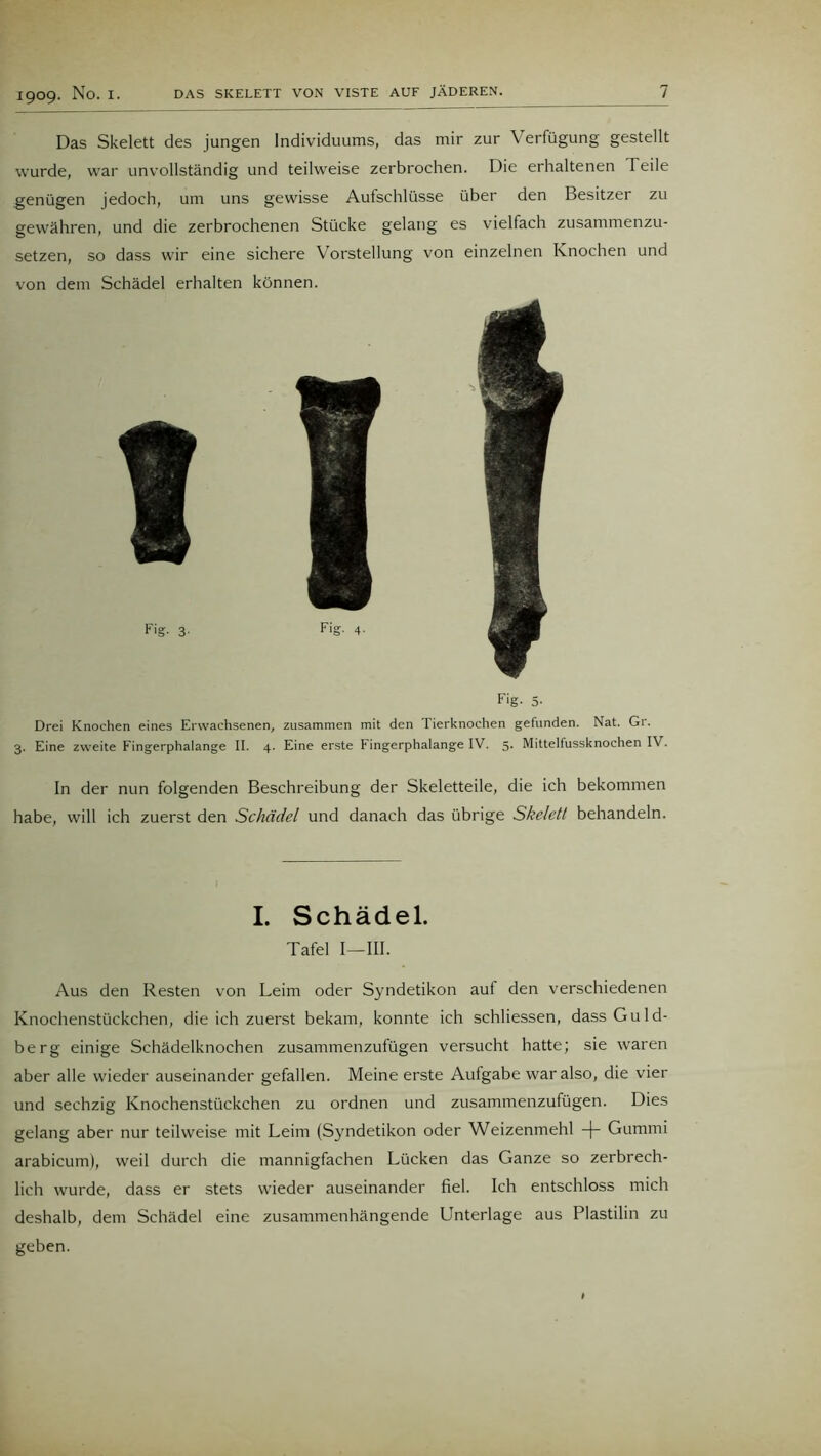 Das Skelett des jungen Individuums, das mir zur Verfügung gestellt wurde, war unvollständig und teilweise zerbrochen. Die erhaltenen Teile genügen jedoch, um uns gewisse Aufschlüsse über den Besitzer zu gewähren, und die zerbrochenen Stücke gelang es vielfach zusammenzu- setzen, so dass wir eine sichere Vorstellung von einzelnen Knochen und von dem Schädel erhalten können. Fig. 5' Drei Knochen eines Erwachsenen, zusammen mit den Tierknochen gefunden. Nat. Gr. 3. Eine zweite Fingerphalange II. 4. Eine erste Fingerphalange IV. 5. Mittelfussknochen IV. In der nun folgenden Beschreibung der Skeletteile, die ich bekommen habe, will ich zuerst den Schädel und danach das übrige Skelett behandeln. I. Schädel. Tafel I—III. Aus den Resten von Leim oder Syndetikon auf den verschiedenen Knochenstückchen, die ich zuerst bekam, konnte ich schliessen, dass Guld- berg einige Schädelknochen zusammenzufügen versucht hatte; sie waren aber alle wieder auseinander gefallen. Meine erste Aulgabe war also, die vier und sechzig Knochenstückchen zu ordnen und zusammenzufügen. Dies gelang aber nur teilweise mit Leim (Syndetikon oder Weizenmehl -)- Gummi arabicum), weil durch die mannigfachen Lücken das Ganze so zerbrech- lich wurde, dass er stets wieder auseinander fiel. Ich entschloss mich deshalb, dem Schädel eine zusammenhängende Unterlage aus Plastilin zu geben.