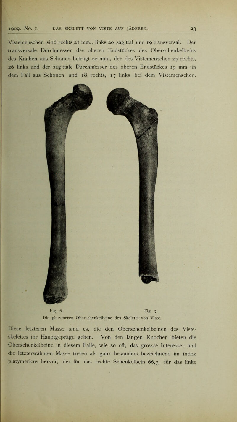 Fig. 6. Fig. 7. Die platymeren Oberschenkelbeine des Skeletts von Viste. Diese letzteren Masse sind es, die den Oberschenkelbeinen des Viste- skelettes ihr Hauptgepräge geben. Von den langen Knochen bieten die Oberschenkelbeine in diesem Falle, wie so oft, das grösste Interesse, und die letzterwähnten Masse treten als ganz besonders bezeichnend im index platymericus hervor, der für das rechte Schenkelbein 66,7, für das linke Vistemenschen sind rechts 21 mm., links 20 sagittal und 19 transversal. Der transversale Durchmesser des oberen Endstückes des Oberschenkelbeins des Knaben aus Schonen beträgt 22 mm., der des Vistemenschen 27 rechts, 26 links und der sagittale Durchmesser des oberen Endstückes 19 mm. in dem Fall aus Schonen und 18 rechts, 17 links bei dem Vistemenschen.