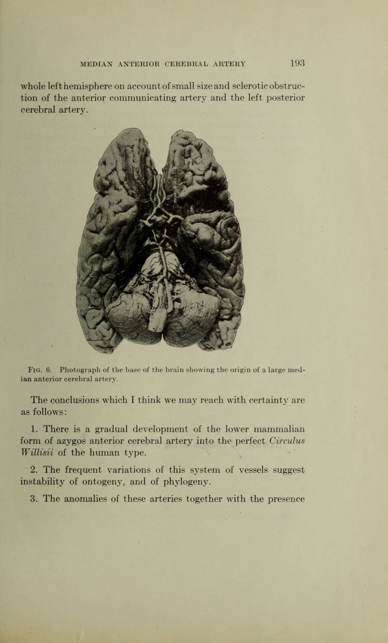 whole left hemisphere on account of small size and sclerot ic obstruc- tion of the anterior communicating artery and the left posterior cerebral artery. Fig. 6. Photograph of the base of the brain showing the origin of a large med- ian anterior cerebral artery. The conclusions which I think we may reach with certainty are as follows: 1. There is a gradual development of the lower mammalian form of azygos anterior cerebral artery into the perfect Circulus Willisii of the human type. 2. The frequent variations of this system of vessels suggest instability of ontogeny, and of phylogenv. 3. The anomalies of these arteries together with the presence