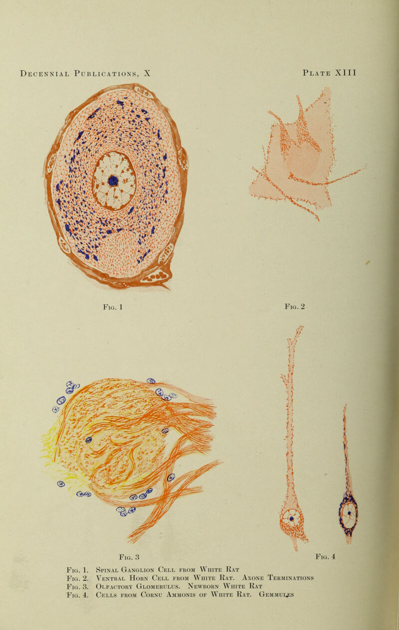 Fig. 1 Fig. 2 Fig. 3 Fig. 1. Spinal Ganglion Cell from White Rat Fig. 2. Ventral Horn Cell from White Rat. Axone Terminations Fig. 3. Olfactory Glomerulus. Newborn White Rat Fig. 4. Cells from Cornu Ammonis of White Rat. Gemmules