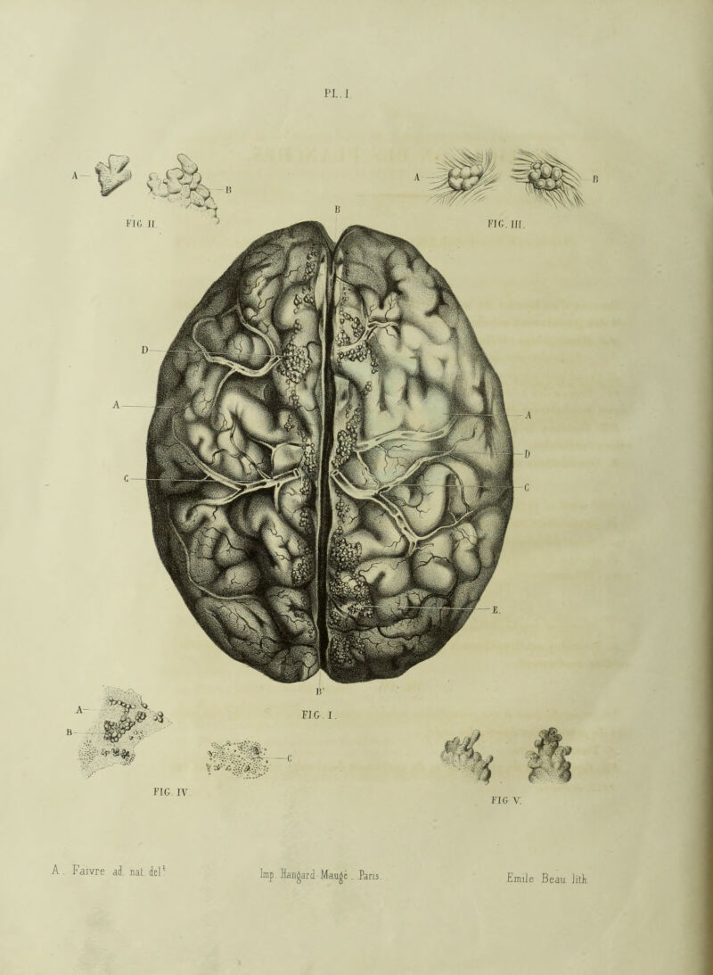 PI.] FIG IV FIG V. A . Faivre ad nat. del1 lmp Hangar d. -Mangé _ Pans Emile Beau M