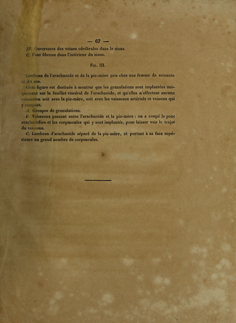 — 67 — l'F. ’uvertures des veines cérébrales dans le sinus. G. t ont fibreux dans l’intérieur du sinus. Fig. III. Lambeau de l’arachnoïde et de la pie-mère pris chez une femme de soixante t d'.x .ois. C< te figure est destinée à montrer que les granulations sont implantées uni- quement sur le feuillet viscéral de l'arachnoïde, et qu’elles n’affectent aucune connexion soit avec la pie-mère, soit avec les vaisseaux artériels et veineux qui y . upent. i. Groupes de granulations. B. Vaisseaux passant entre l’arachnoïde et la pie-mère : on a coupé le pont arachnoïdien et les corpuscules qui y sont implantés, pour laisser voir le trajet du vaisseau. C. Lambeau d’arachnoïde séparé de la pie-mère, et portant à sa face supé- rieure un grand nombre de corpuscules.