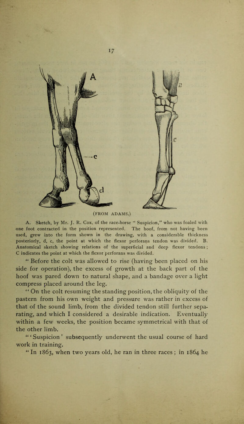 (FROM ADAMS.) A. Sketch, by Mr. J. R. Cox, of the race-horse “ Suspicion,” who was foaled with one foot contracted in the position represented. The hoof, from not having been used, grew into the form shown in the drawing, with a considerable thickness posteriorly, d, c, the point at which the flexor perforans tendon was divided. B. Anatomical sketch showing relations of the superficial and deep flexor tendons; C indicates the point at which the flexor perforans was divided. “ Before the colt was allowed to rise (having been placed on his side for operation), the excess of growth at the back part of the hoof was pared down to natural shape, and a bandage over a light compress placed around the leg. “ On the colt resuming the standing position, the obliquity of the pastern from his own weight and pressure was rather in excess of that of the sound limb, from the divided tendon still further sepa- rating, and which I considered a desirable indication. Eventually within a few weeks, the position became symmetrical with that of the other limb. “‘Suspicion’ subsequently underwent the usual course of hard work in training. “ In 1863, when two years old, he ran in three races ; in 1864 he