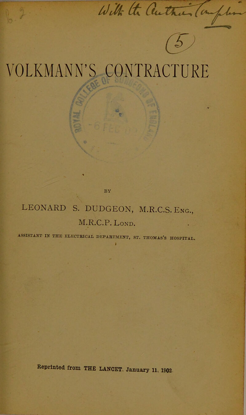 VOLKMANN’S CONTRACTURE BY LEONARD S. DUDGEON, M.R.C.S. Eng., M.R.C.P. Lond. ASSISTANT IN THE ELECTRICAL DEPARTMENT, ST. THOMAS’S HOSPITAL. Reprinted from THE LANCET, January 11, 1902