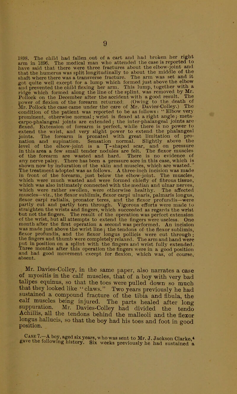 1898. The child had fallen .out of a cart and had broken her right arm in 1896. The medical man who attended the case is reported to have said that there were three fractures about the elbow-joint and that the humerus was split longitudinally to about the middle of the shaft where there was a transverse fracture. The arm was set and it got quite well except for a lump which formed just above the elbow and prevented the child flexing her arm. This lump, together with a ridge which formed along the line of Ihe splint, was removed by Mr. Pollock on the December after the accident with a good result. The power of flexion of the forearm returned (Owing to the death of Mr. Pollock the case came under the care of Mr. Davies-Colley.) The condition of the patient was reported to be as follows : “ Elbow very prominent, otherwise normal; wrist is flexed at aright angle; meta- carpo-phalangeal joints are extended ; the inter-phalangeal joints are flexed. Extension of forearm is perfect, while there is no power to extend the wiist, and very slight power to extend the phalangeal joints. The forearm is pronated with great limitation of pro- nation and supination. Sensation normal. Slightly above the level of the elbow-joint is a T-shaped scar, and on pressure in this area a few small tender nodules are felt. The flexor muscles of the forearm are wasted and hard. There is no evidence of any nerve palsy. There has been a pressure sore in this case, which is shown now by induration of the skin and muscles, which are wasted.'' The treatment adopted was as follows. A three-inch incision was made in front of the forearm, just below the elbow-joint. The muscles, which were much wasted and were formed chiefly of fibrous tissue, which was also intimately connected with the median and ulnar nerves, which were rather swollen, were otherwise healthy. The affected muscles—viz., the flexor sublimis, flexor carpi ulnaris, palmaris longus, flexor carpi radialis, pronator teres, and the flexor profundis—were partly cut and partly torn through. Vigorous efforts were made to straighten the wrists and fingers, which succeeded as regards the wrist but not the fingers. The result of the operation was perfect extension of the wrist, but all attempts to extend the fingers were useless. One month after the first operation a second was performed. An incision was made just above the wrist line ; the tendons of the flexor sublimis, flexor profundis, and the flexor longus pollicis were cut through ; the fingers and thumb were completely relaxed. The arm and hand were put in position on a splint with the fingers and wrist fully extended. Three months after this operation the fingers were in a good position and had good movement except for flexion, which was, of course, absent. Mr. Davies-Colley, in the same paper, also narrates a case of myositis in the calf muscles, that of a boy with very bad talipes equinus, so that the toes were pulled down so much that they looked like “claws.” Two years previously he had sustained a compound fracture of the tibia and fibula, the calf muscles being injured. The parts healed after long suppuration. Mr. Davies-Colley had divided the tendo Acliillis, all the tendons behind the malleoli and the flexor longus liallucis, so that the boy had his toes and foot in good position. ° boiy’ age<l six years, who was sent to Mr. J. Jackson Clarke,4 gave the following history. Six weeks previously he had sustained a