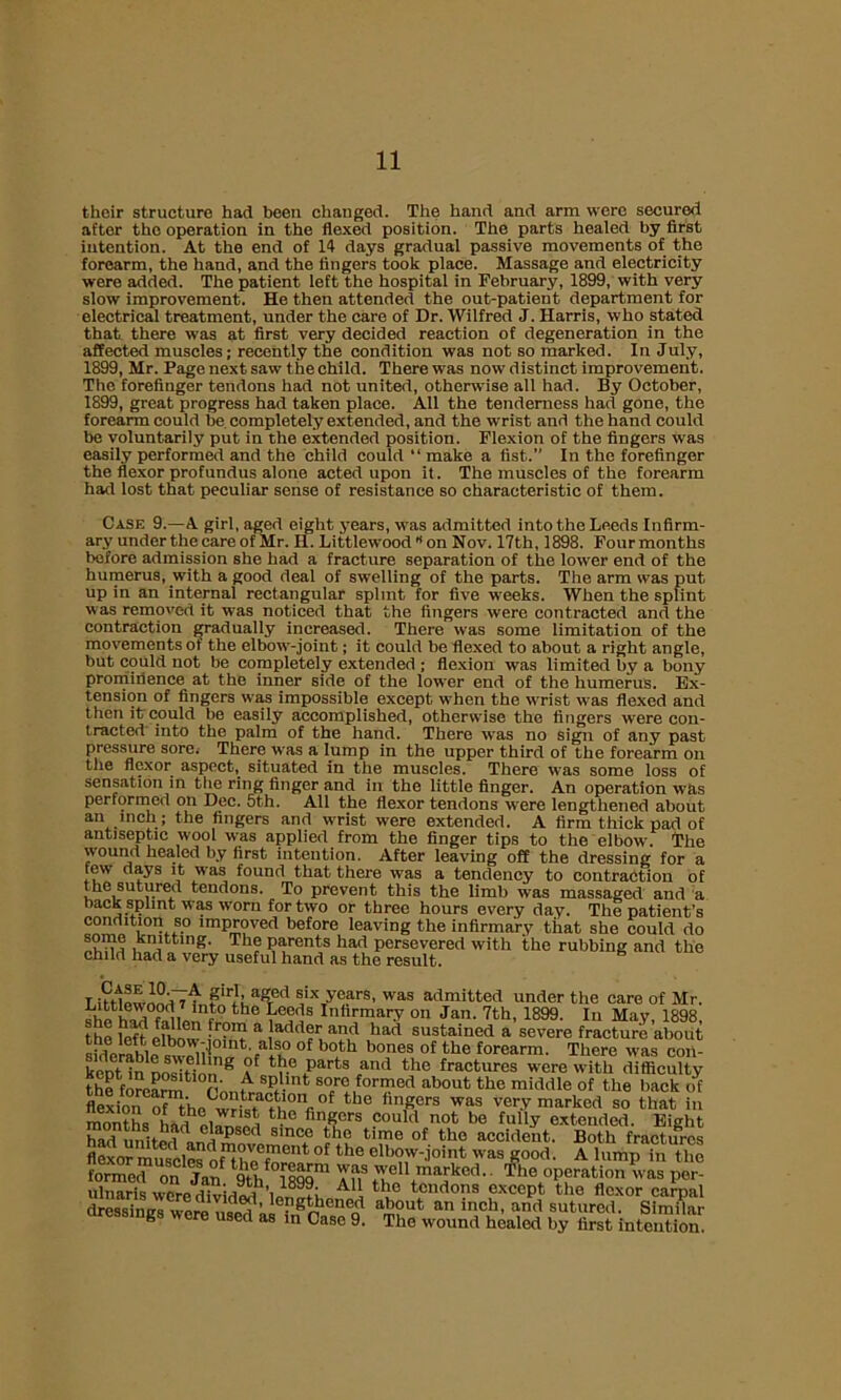 their structure had been changed. The hand and arm were secured after the operation in the flexed position. The parts healed by first intention. At the end of 14 days gradual passive movements of the forearm, the hand, and the fingers took place. Massage and electricity were added. The patient left the hospital in February, 1899, with very slow improvement. He then attended the out-patient department for electrical treatment, under the care of Dr. Wilfred J. Harris, who stated that there was at first very decided reaction of degeneration in the affected muscles; recently the condition was not so marked. In July, 1899, Mr. Page next saw the child. There was now distinct improvement. The forefinger tendons had not united, otherwise all had. By October, 1899, great progress had taken place. All the tenderness had gone, the forearm could be completely extended, and the wrist and the hand could be voluntarily put in the extended position. Flexion of the fingers was easily performed and the child could “ make a fist. In the forefinger the flexor profundus alone acted upon it. The muscles of the forearm had lost that peculiar sense of resistance so characteristic of them. Case 9.—A girl, aged eight years, was admitted into the Leeds Infirm- ary under the care of Mr. H. Littlewood B on Nov. 17th, 1898. Four months before admission she had a fracture separation of the lower end of the humerus, with a good deal of swelling of the parts. The arm was put up in an internal rectangular splint for five weeks. When the splint was removed it was noticed that the fingers were contracted and the contraction gradually increased. There was some limitation of the movements ot the elbow-joint; it could be flexed to about a right angle, but could not be completely extended ; flexion was limited by a bony prominence at the inner side of the lower end of the humerus. Ex- tension of fingers was impossible except when the wrist was flexed and then it could be easily accomplished, otherwise the fingers were con- tracted into the palm of the hand. There was no sign of any past pressure sore. There was a lump in the upper third of the forearm ou the flexor aspect, situated in the muscles. There was some loss of sensation in the ring finger and in the little finger. An operation was performed on Dec. 5th. All the flexor tendons were lengthened about an inch; the fingers and w'rist were extended. A firm thick pad of antiseptic wool was applied from the finger tips to the elbow. The wound healed by first intention. After leaving off the dressing for a tew days it was found that there was a tendency to contraction of the sutured tendons. To prevent this the limb was massaged and a back sphnt was worn for two or three hours every day. The patient’s condition so improved before leaving the infirmary that she could do s knitting. The parents had persevered with the rubbing and the child had a very useful hand as the result. T UHewnnuT are<1 six years, w-as admitted under the care of Mr. , the Leeds Infirmary on Jan. 7th, 1899. In May, 1898 the {eft elhmv fr0'? a ,ladd?r and h;lfl sustained a severe fracture about sMerablfsw^i' na °f b°ith b0nes of the forearm- Tliere was coii- konUn nos Hon 8 aE ^ iparts ,an<1 the fractures were with difficulty thTflL! ' A sP1.lnfc sorc formed about the middle of the back of tatoHFuuiDS°?f the (inSers was very marked so that in months hadhel^n ° fin*lcrs could not be fuy extended. Eight had nnfipri d 8lnc? f'ie tlme °f the accident. Both fractures flexor muscles oM? phf”6114 °f the elbow-joint was good. A lump in the forme” on Jan 9th 1899” aIT tTA^ked The operation was per- ulnaris were i AU the tendons except the flexor carpal lengthened about an inch, and sutured. Similar dressings were used as in Case 9. The wound healed by first intention