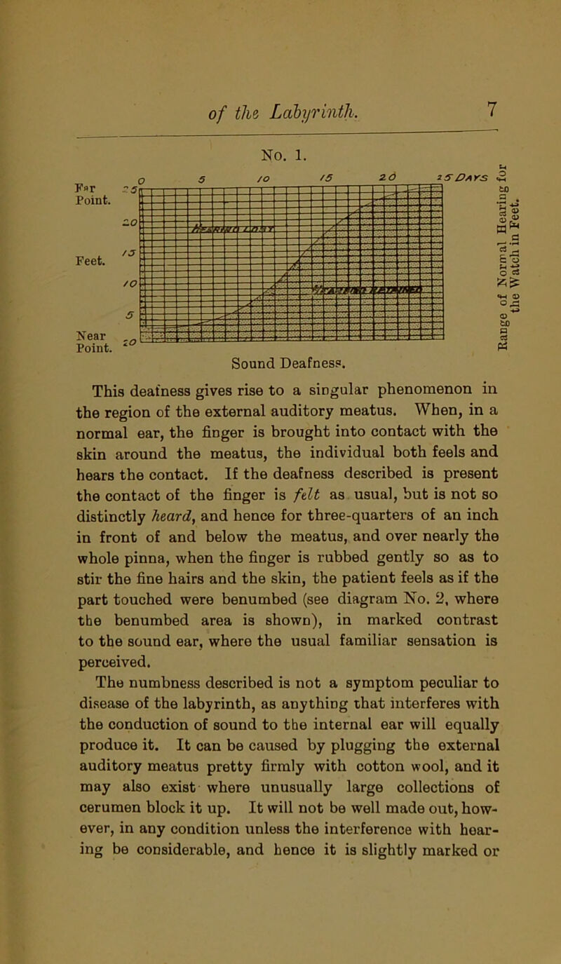 No. l. This deafness gives rise to a singular phenomenon in the region of the external auditory meatus. When, in a normal ear, the finger is brought into contact with the skin around the meatus, the individual both feels and hears the contact. If the deafness described is present the contact of the finger is felt as usual, but is not so distinctly heard, and hence for three-quarters of an inch in front of and below the meatus, and over nearly the whole pinna, when the finger is rubbed gently so as to stir the fine hairs and the skin, the patient feels as if the part touched were benumbed (see diagram No. 2, where tbe benumbed area is shown), in marked contrast to the sound ear, where the usual familiar sensation is perceived. The numbness described is not a symptom peculiar to disease of the labyrinth, as anything that interferes with the conduction of sound to the internal ear will equally produce it. It can be caused by plugging the external auditory meatus pretty firmly with cotton wool, and it may also exist where unusually large collections of cerumen block it up. It will not be well made out, how- ever, in any condition unless the interference with hear- ing be considerable, and hence it is slightly marked or Range of Normal Hearing for the Watch in Feet.